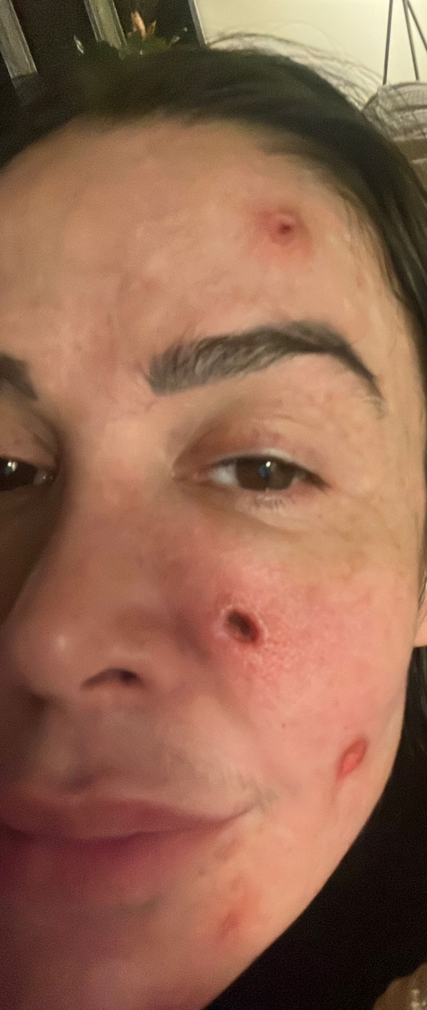 Donate to help me recovery my skin and come back to work! campaign photo, 4 of 8