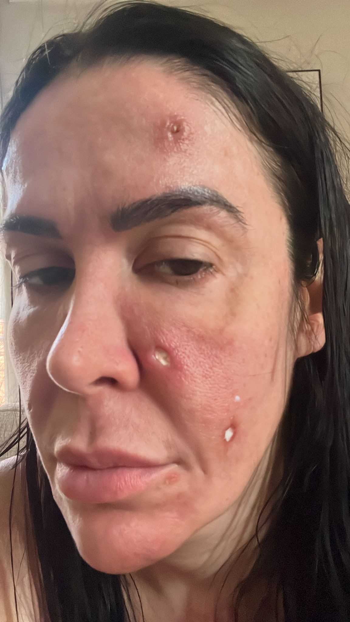 Donate to help me recovery my skin and come back to work! campaign photo, 2 of 8