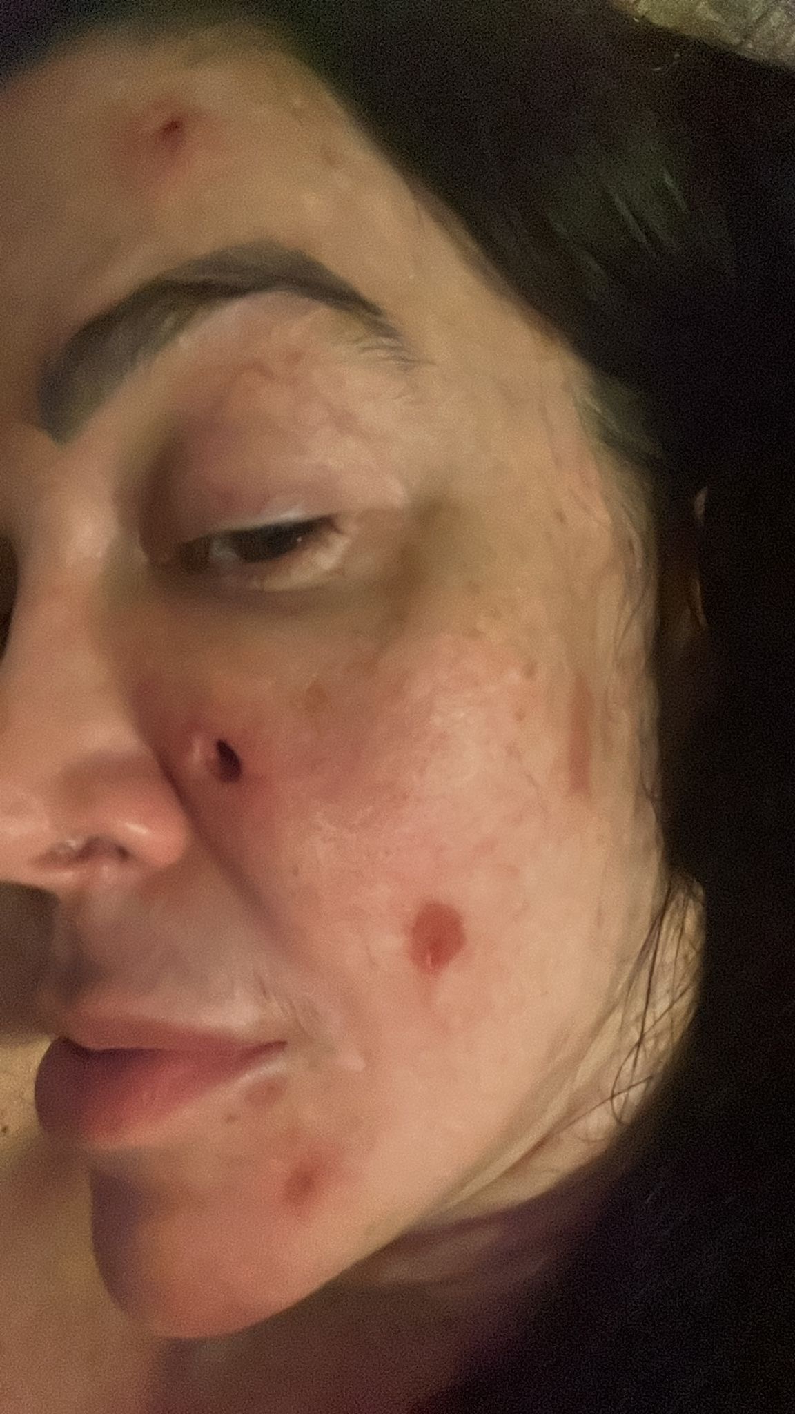 Donate to help me recovery my skin and come back to work! campaign photo, 6 of 8