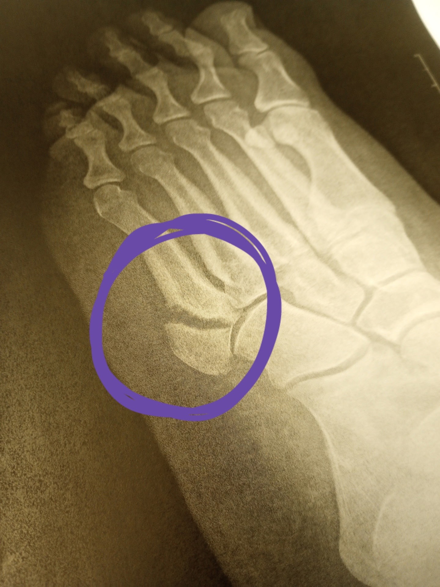 Car Crash & Surgery: A Mom's Urgent Plea campaign photo, 5 of 7