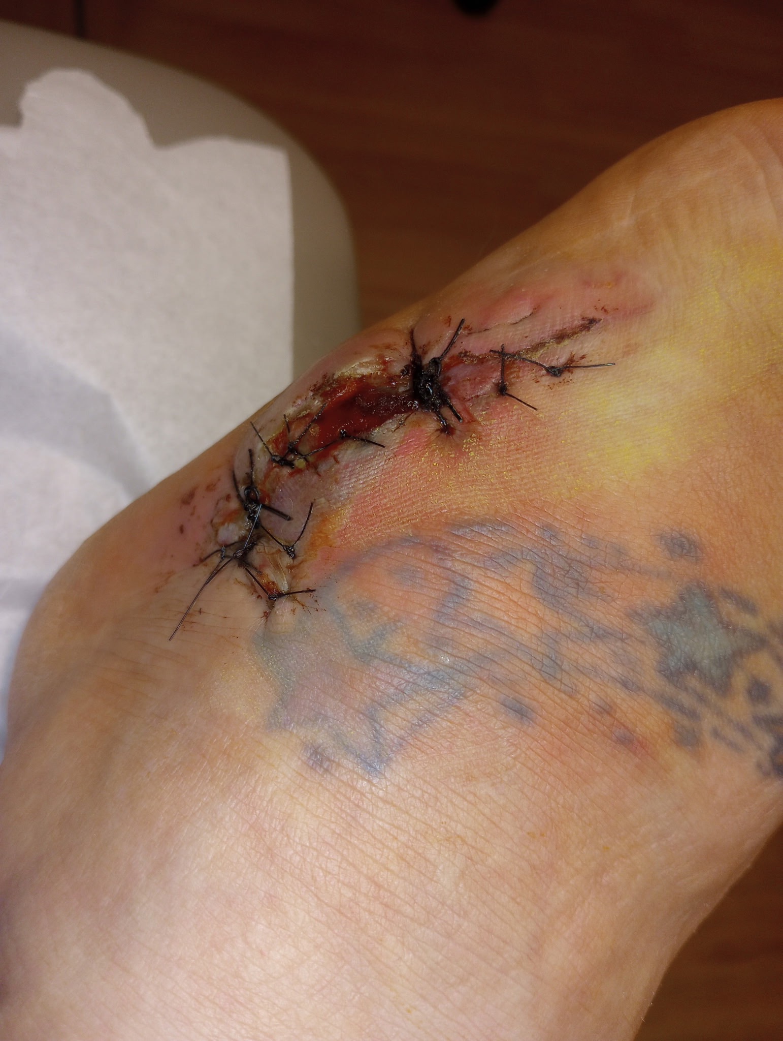 Car Crash & Surgery: A Mom's Urgent Plea campaign photo, 4 of 7