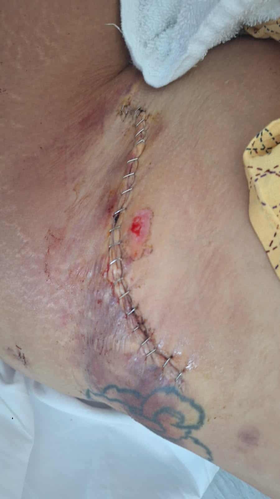 Michele’s long road to recovery campaign photo, 2 of 8