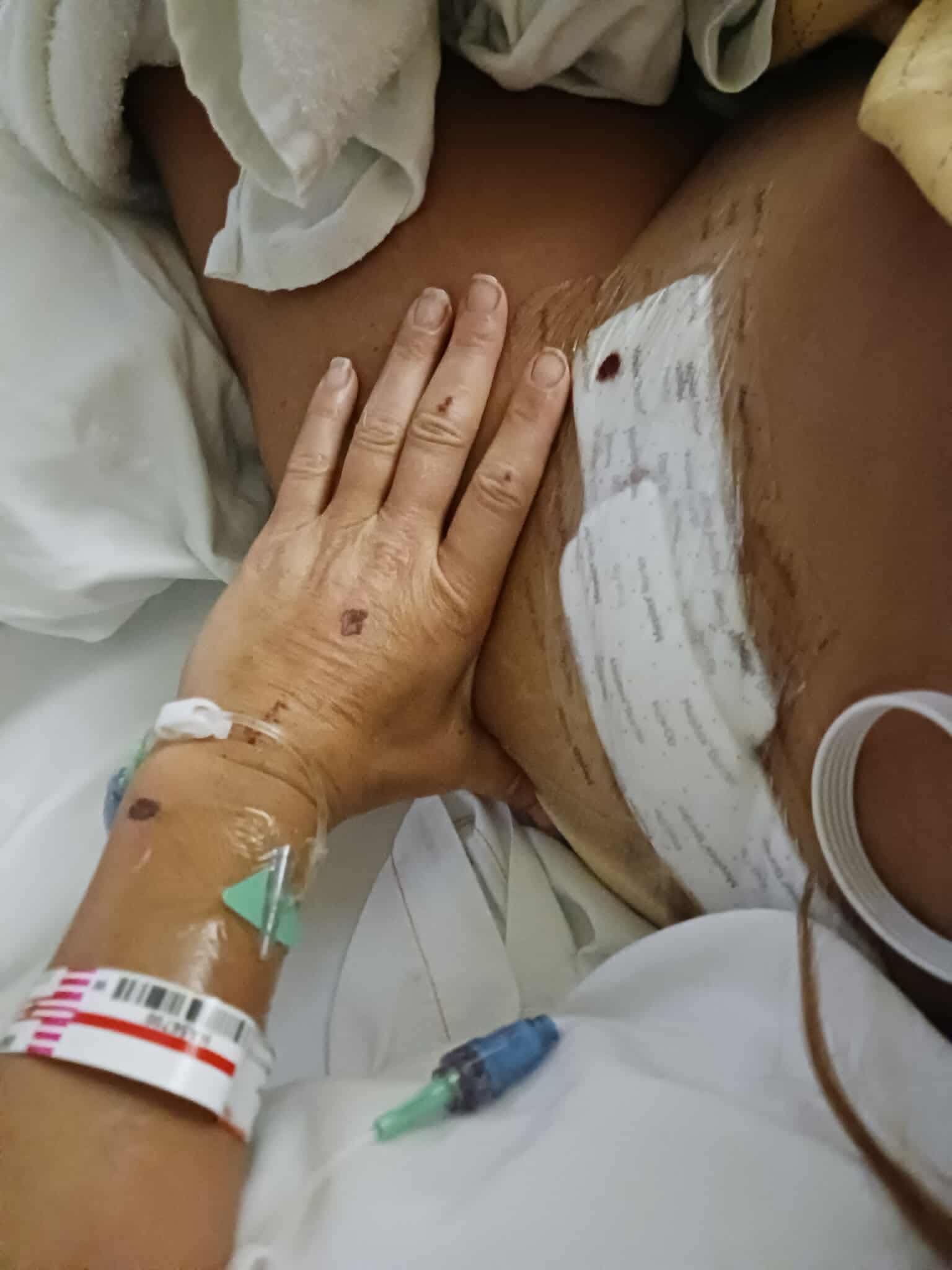 Michele’s long road to recovery campaign photo, 5 of 8