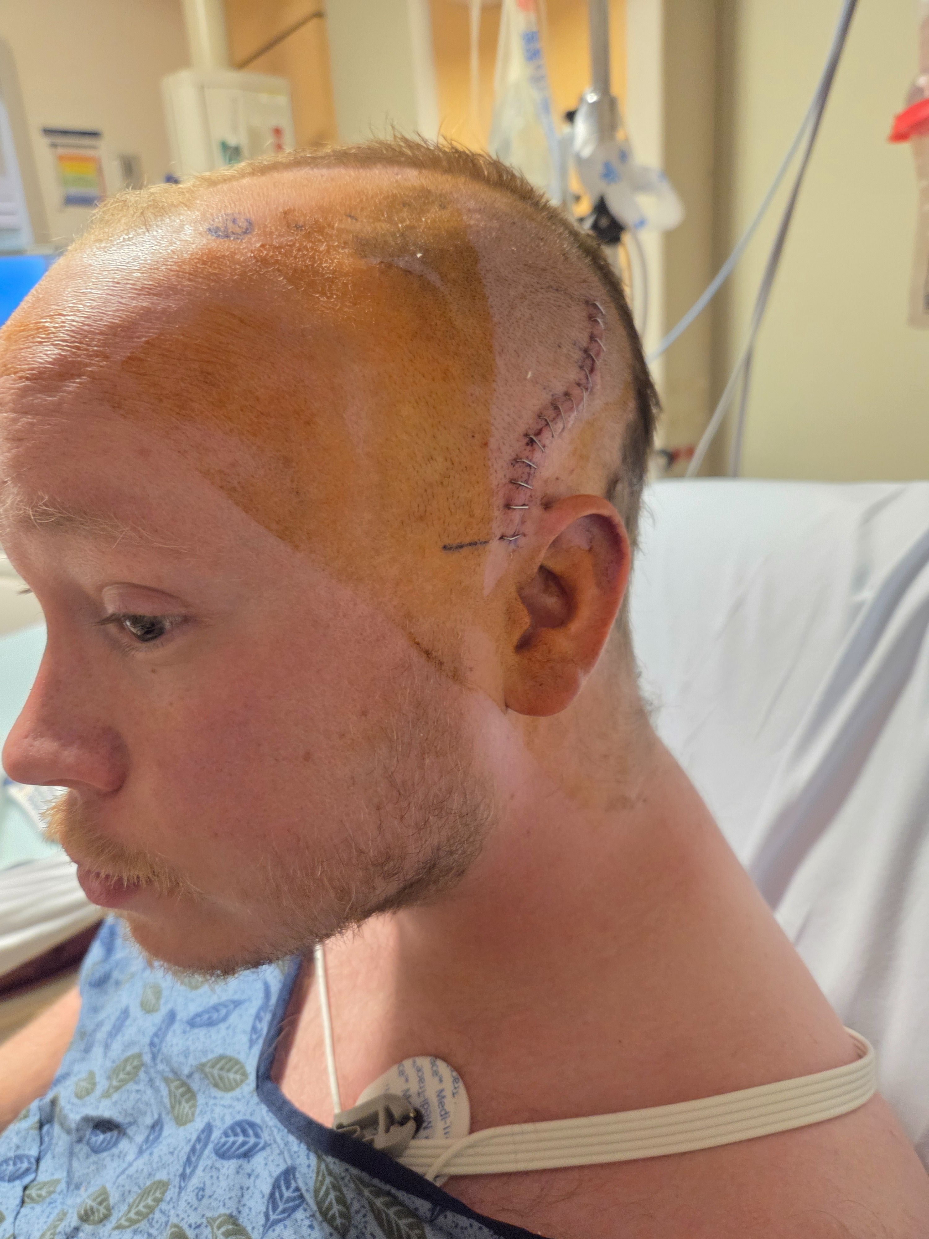 Support Nolan's Recovery After Brain Surgery campaign photo, 2 of 4