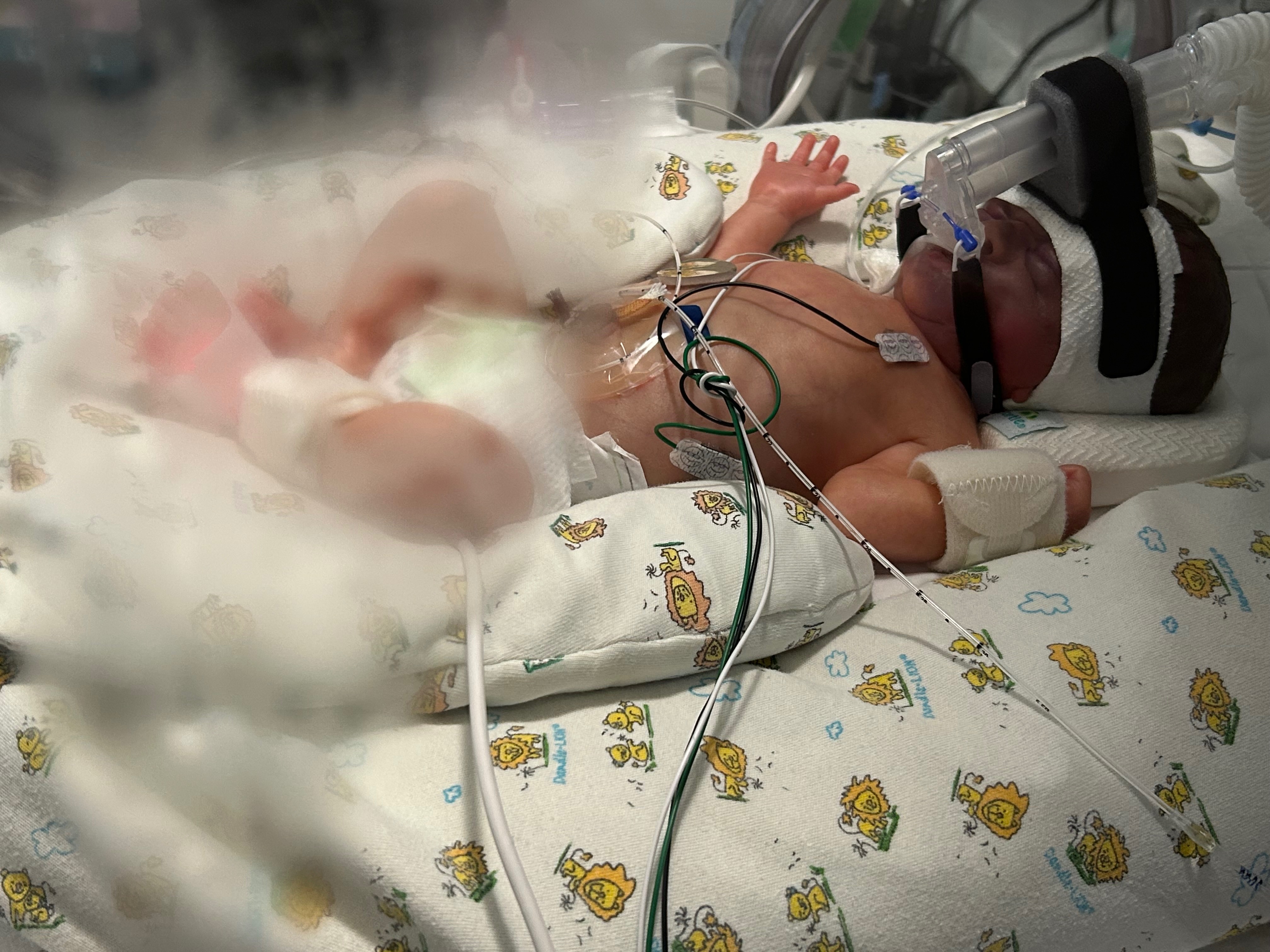 Born too soon, Loved beyond measure. Let’s show support! campaign photo, 4 of 7