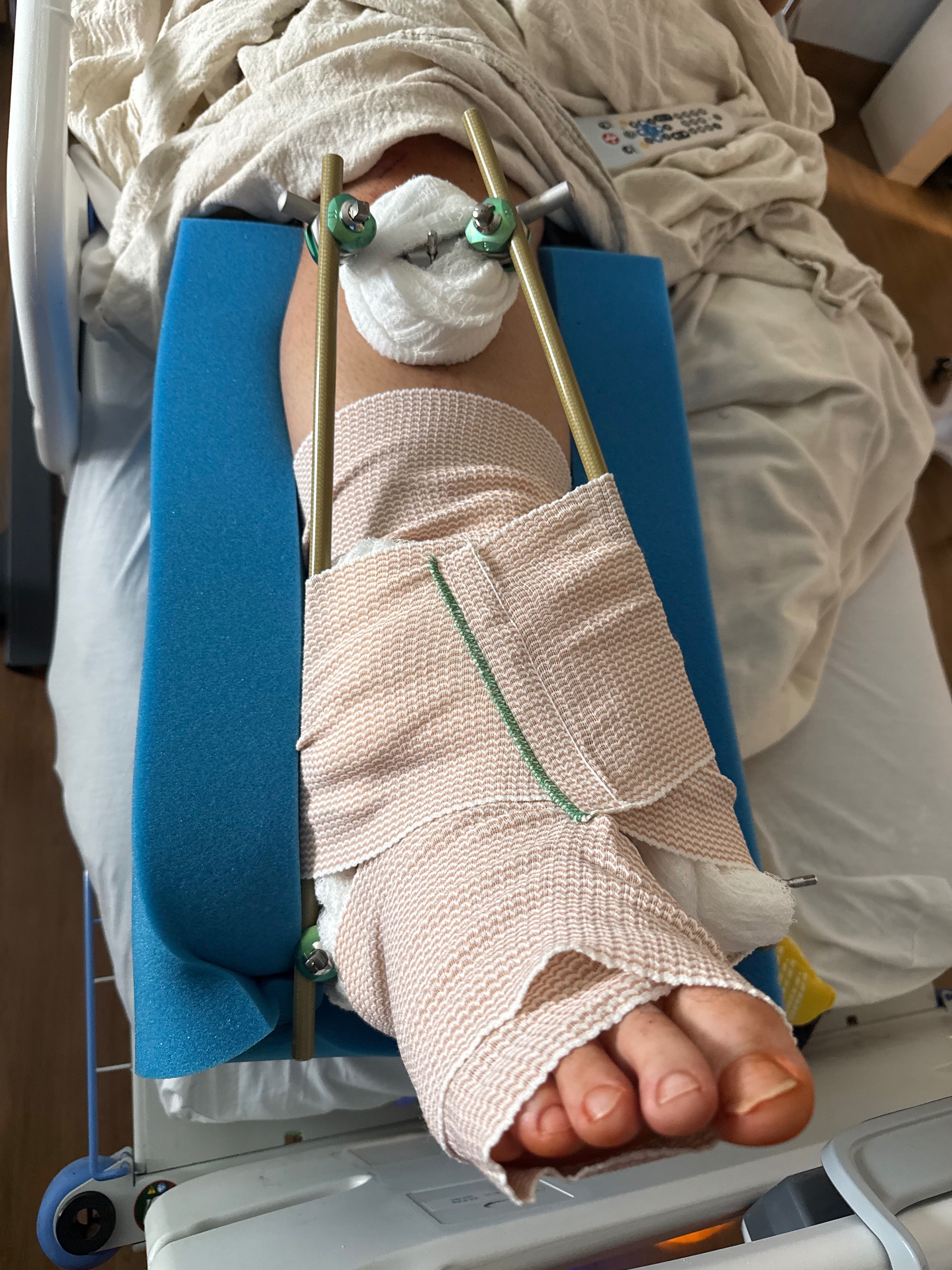 Support Wyatt’s Long Road to Recovery campaign photo, 5 of 7