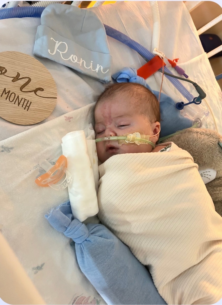 Help Baby Ronin Fight Rare Disorders campaign photo, 4 of 5