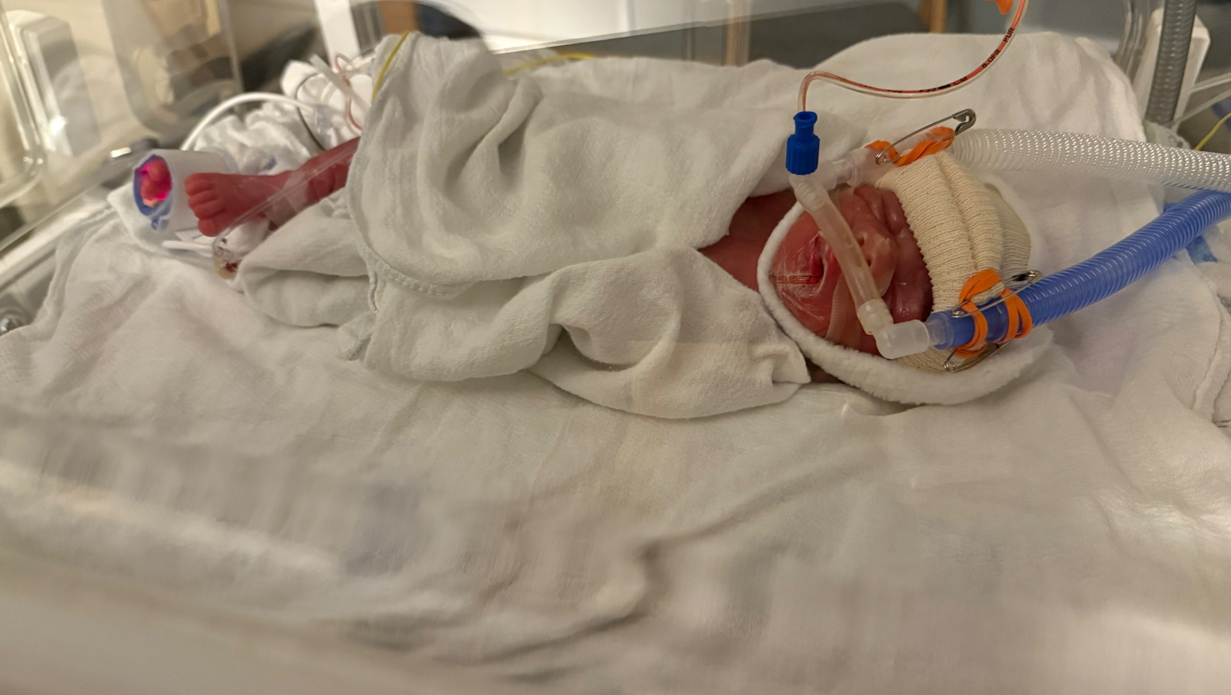 Join Us in Supporting Dori, Rony, & Baby's NICU Journey