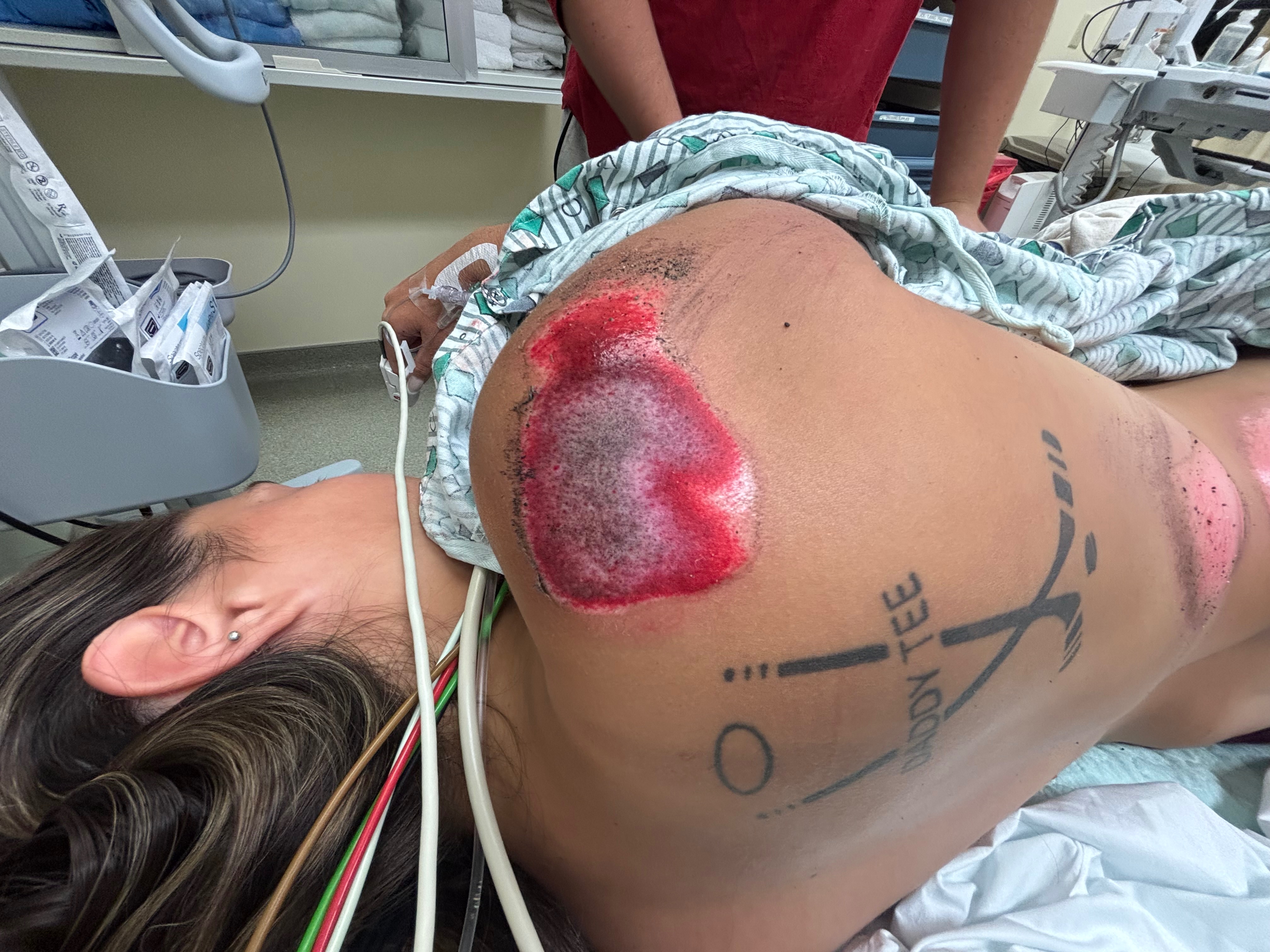 Rally for Maddy: Overcoming Her Accident campaign photo, 4 of 8