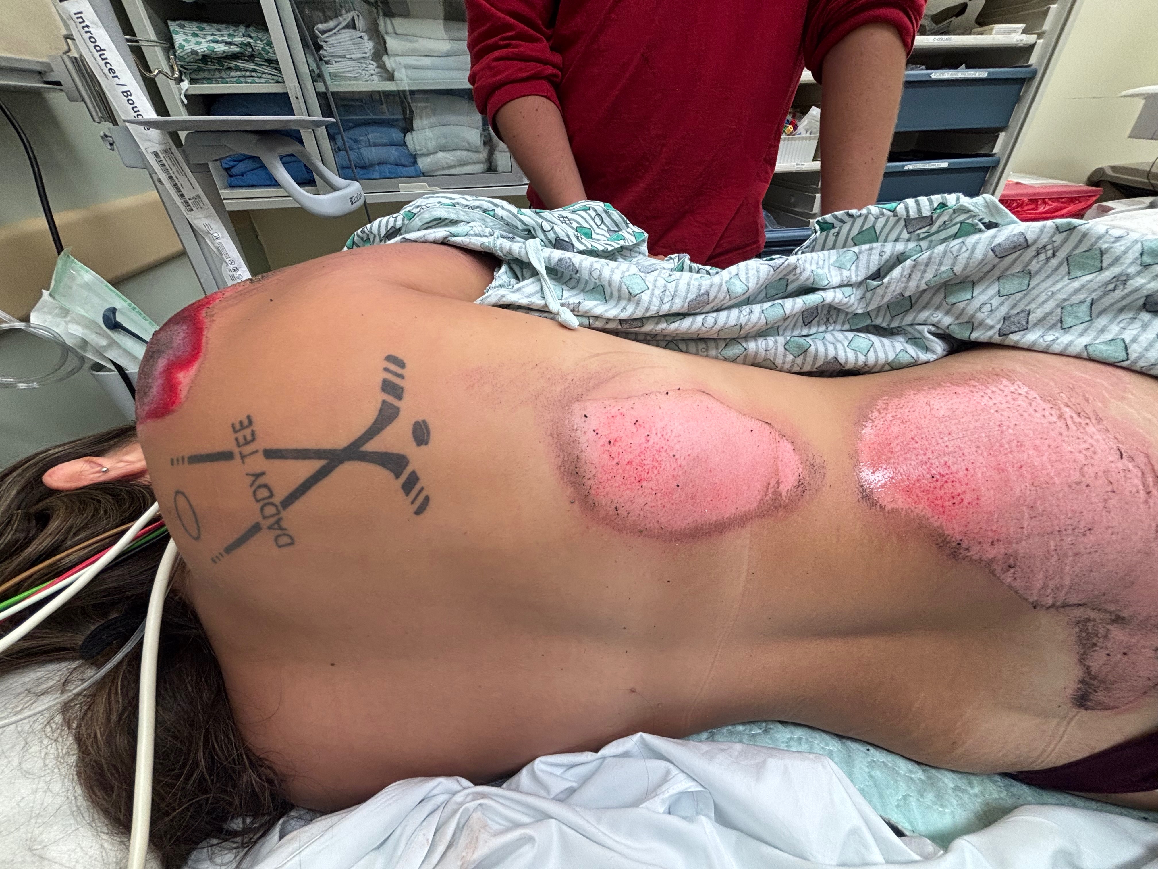Rally for Maddy: Overcoming Her Accident campaign photo, 6 of 8