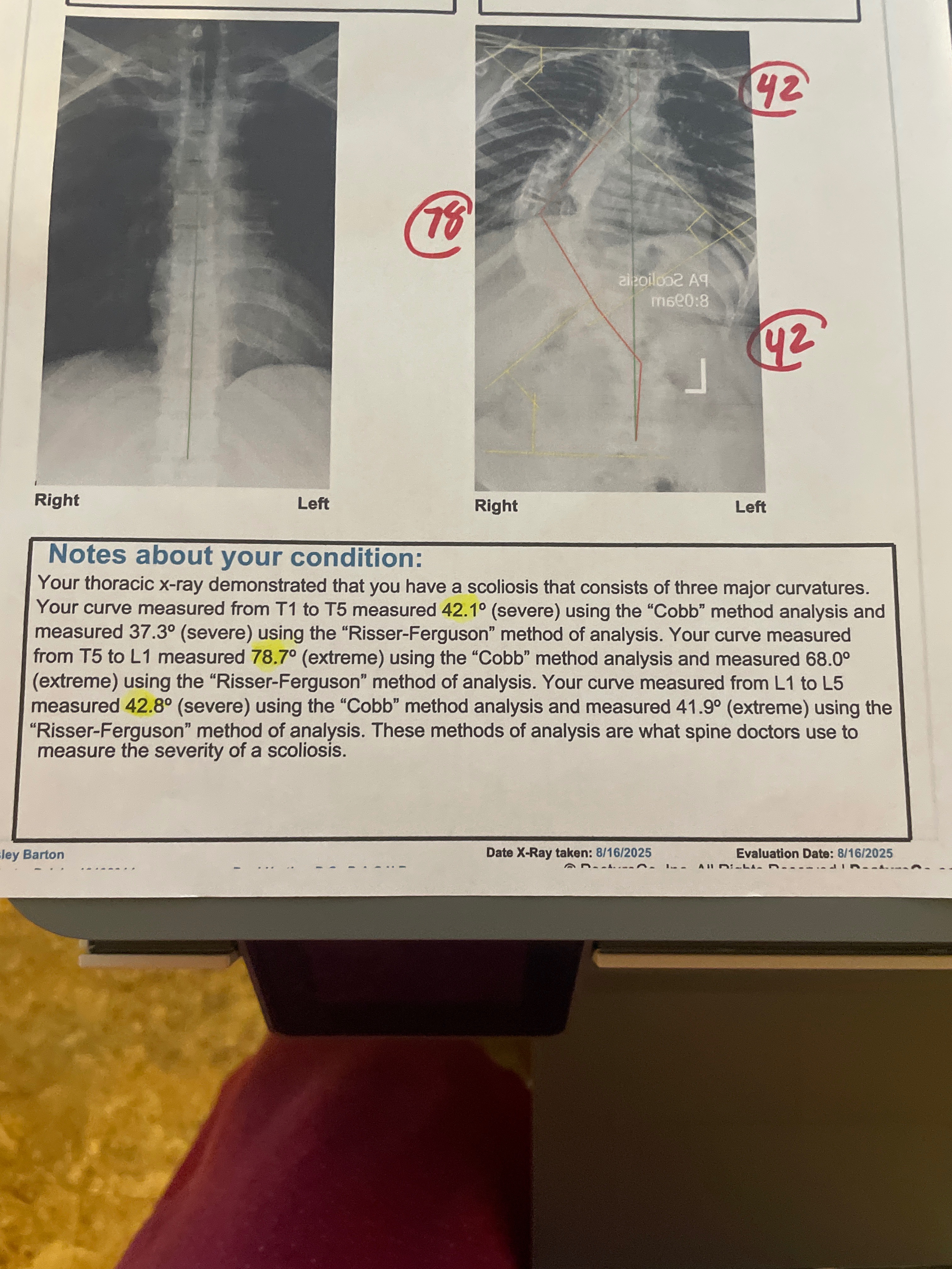 Please help our baby girl get the surgery she needs campaign photo, 2 of 8