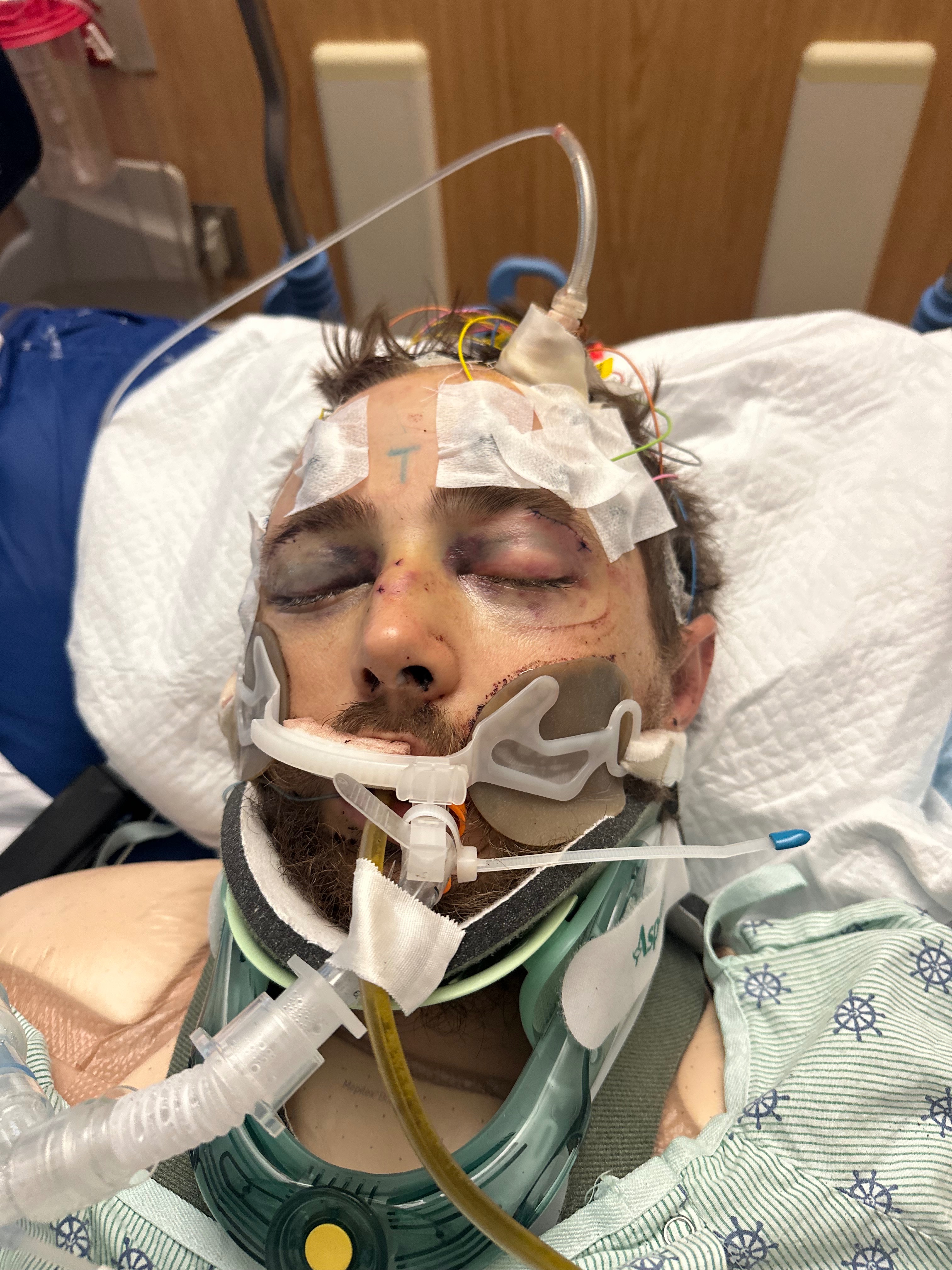 Support Blaine's Journey to Recovery campaign photo, 2 of 6