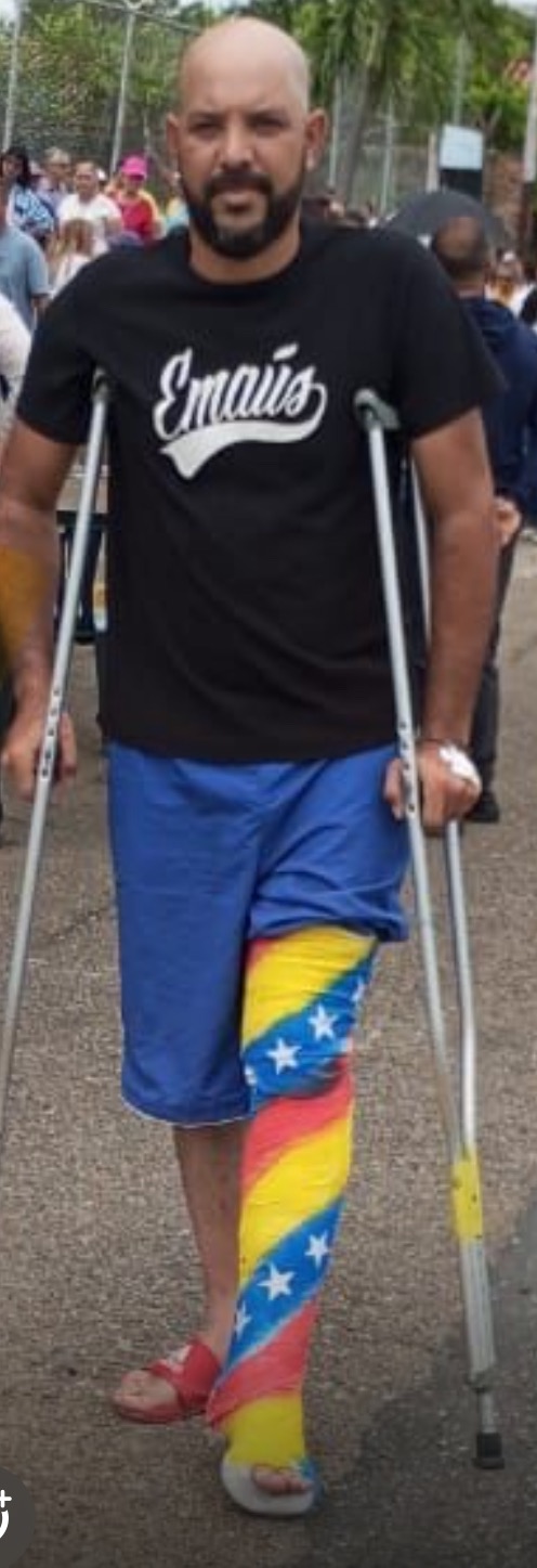 URGENT: Help me save my leg and my life campaign photo, 6 of 8