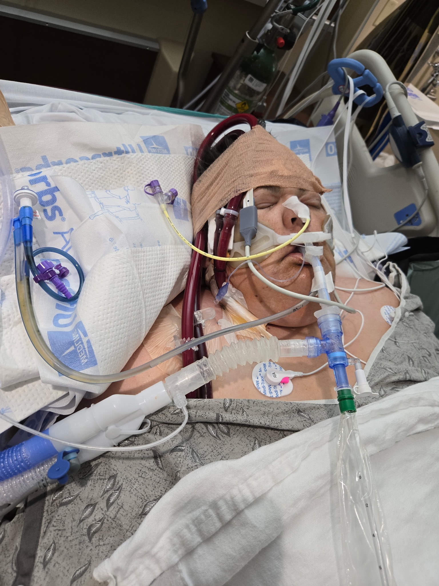 Jennifer's Journey: From ICU to Recovery campaign photo, 5 of 8