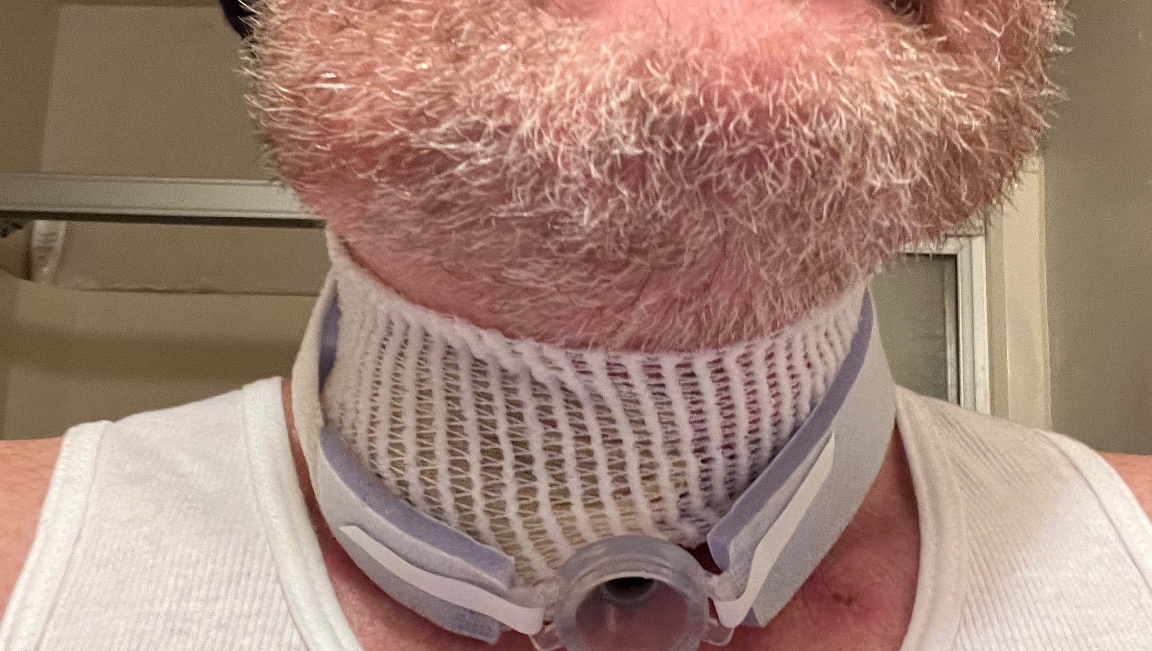 Support William’s Ongoing Cancer & Accident Care