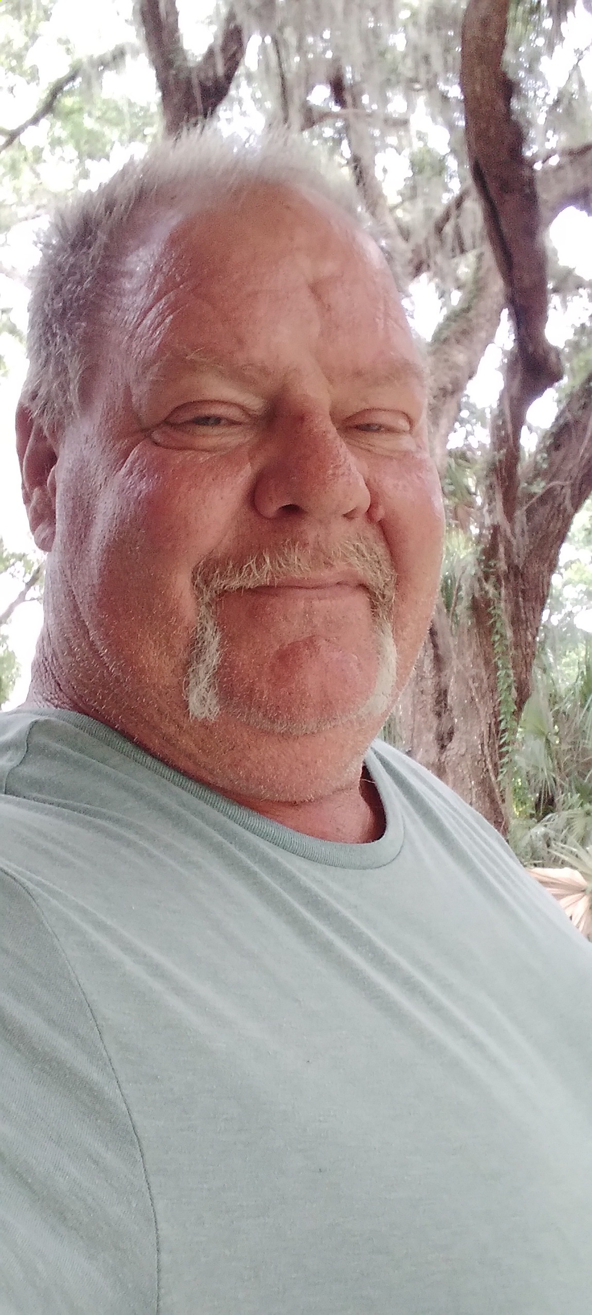Help Jim Omuletz Overcome Amputation Challenges campaign photo, 2 of 4
