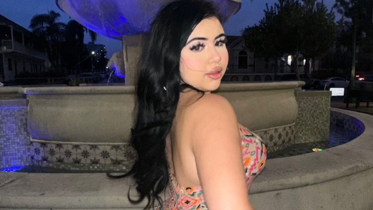 Support Her Dream: Plastic Surgery Fund photo