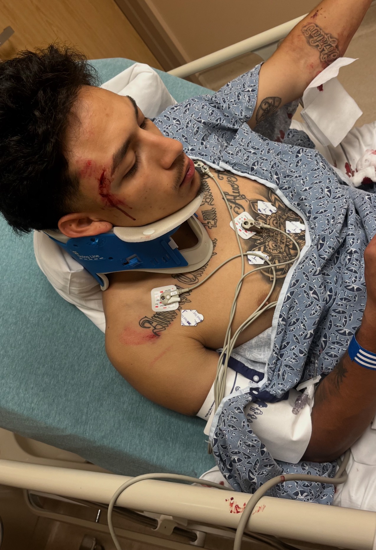 Help Tez After Motorcycle Accident campaign photo, 4 of 6