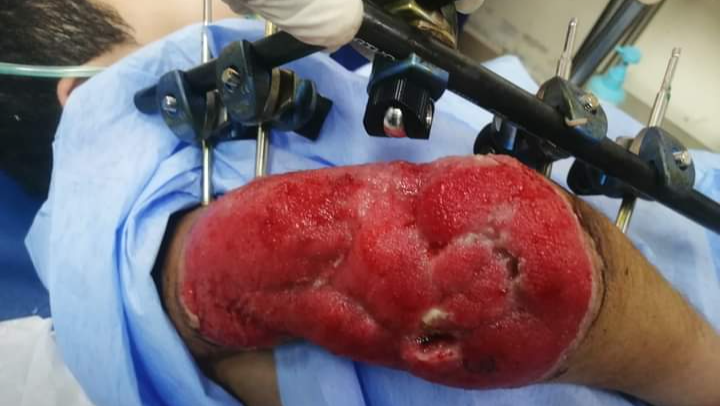 Support Kenan's Surgery and Family's Healing photo