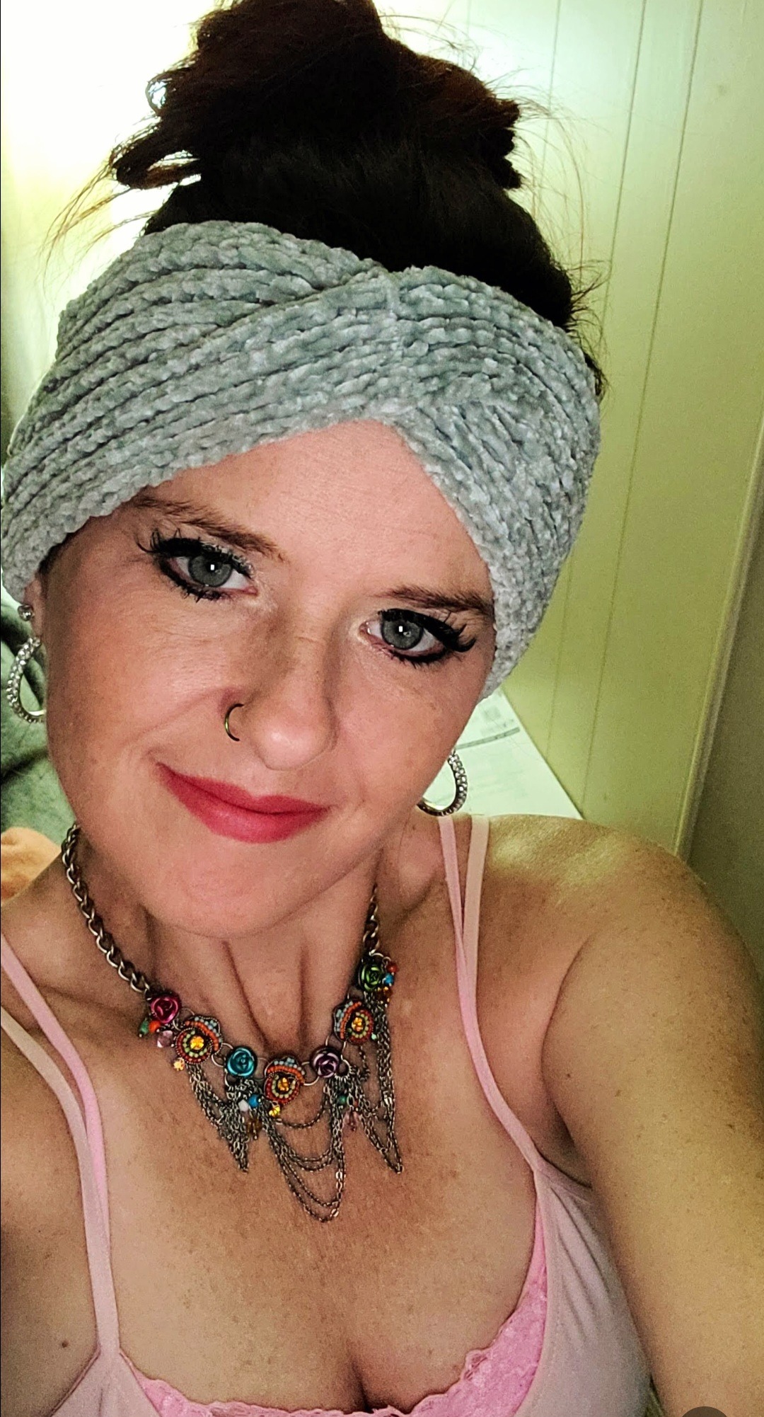 Donate for Jennifer's Vital Bone Graft Surgery campaign photo, 2 of 4