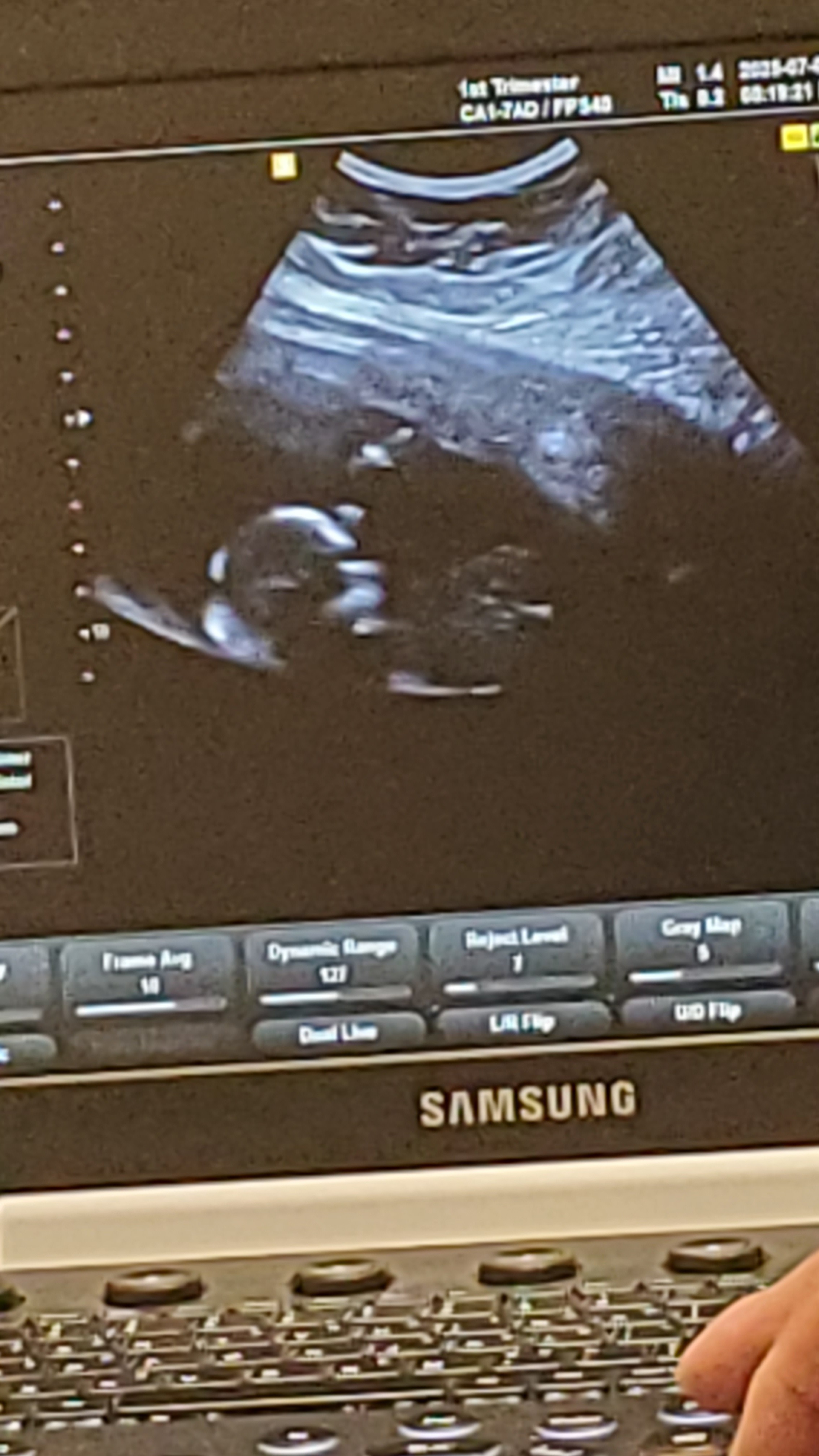 Support Tylee and Elias After Loss of Their Angel Baby Boy campaign photo, 2 of 4