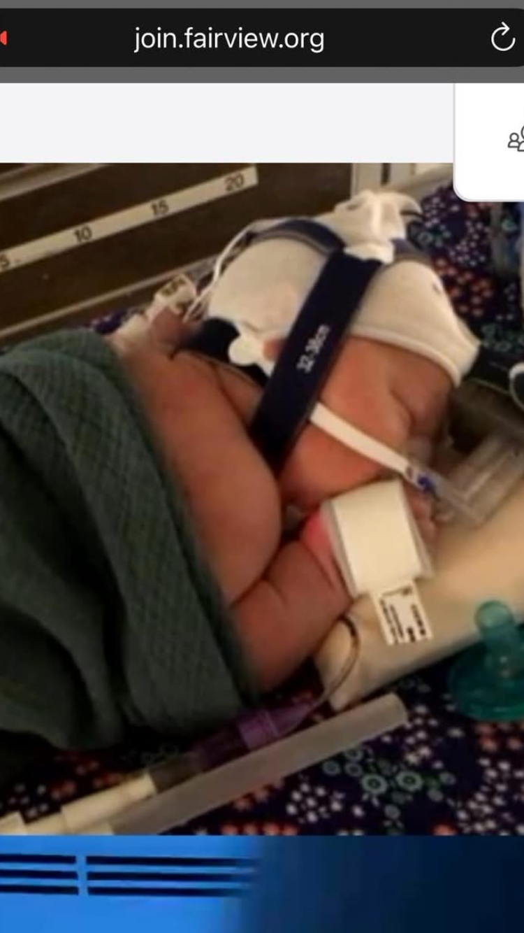Donate to Help Baby Edens recovery campaign photo, 2 of 7