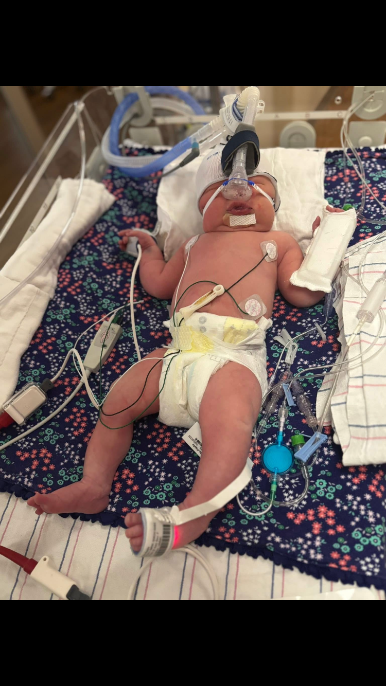 Donate to Help Baby Edens recovery campaign photo, 5 of 7