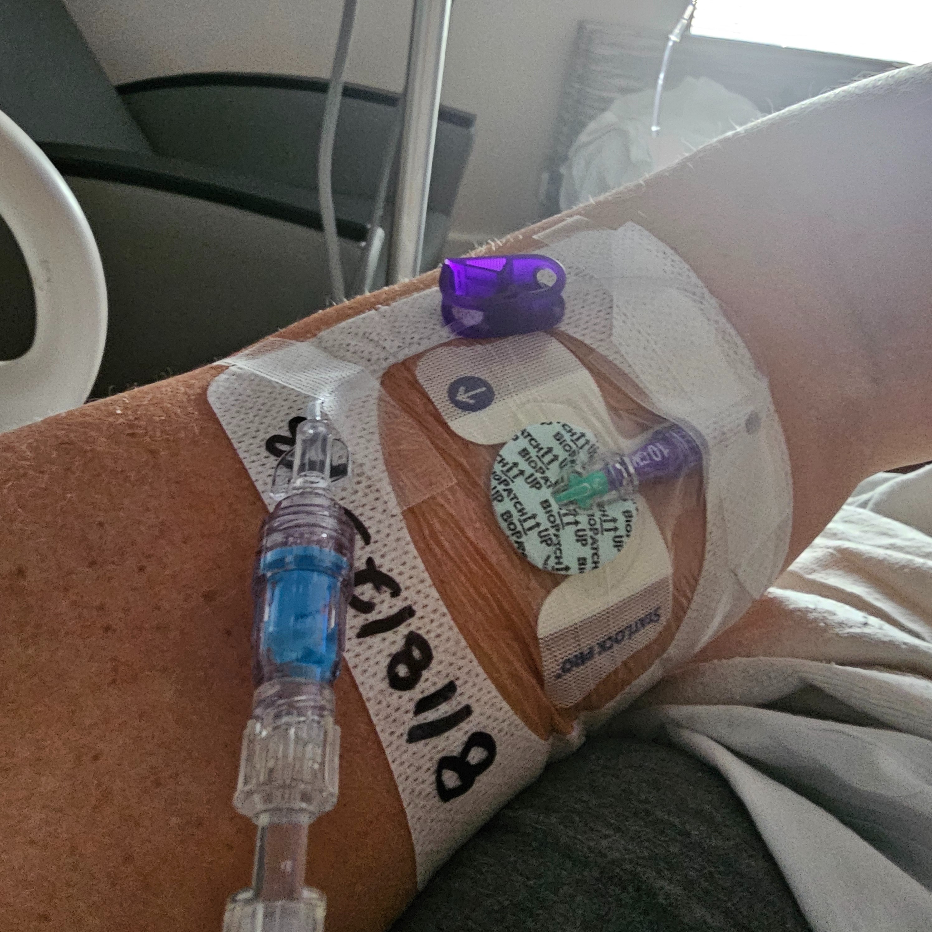 Support Melissa After Several Surgeries & Complications campaign photo, 2 of 8