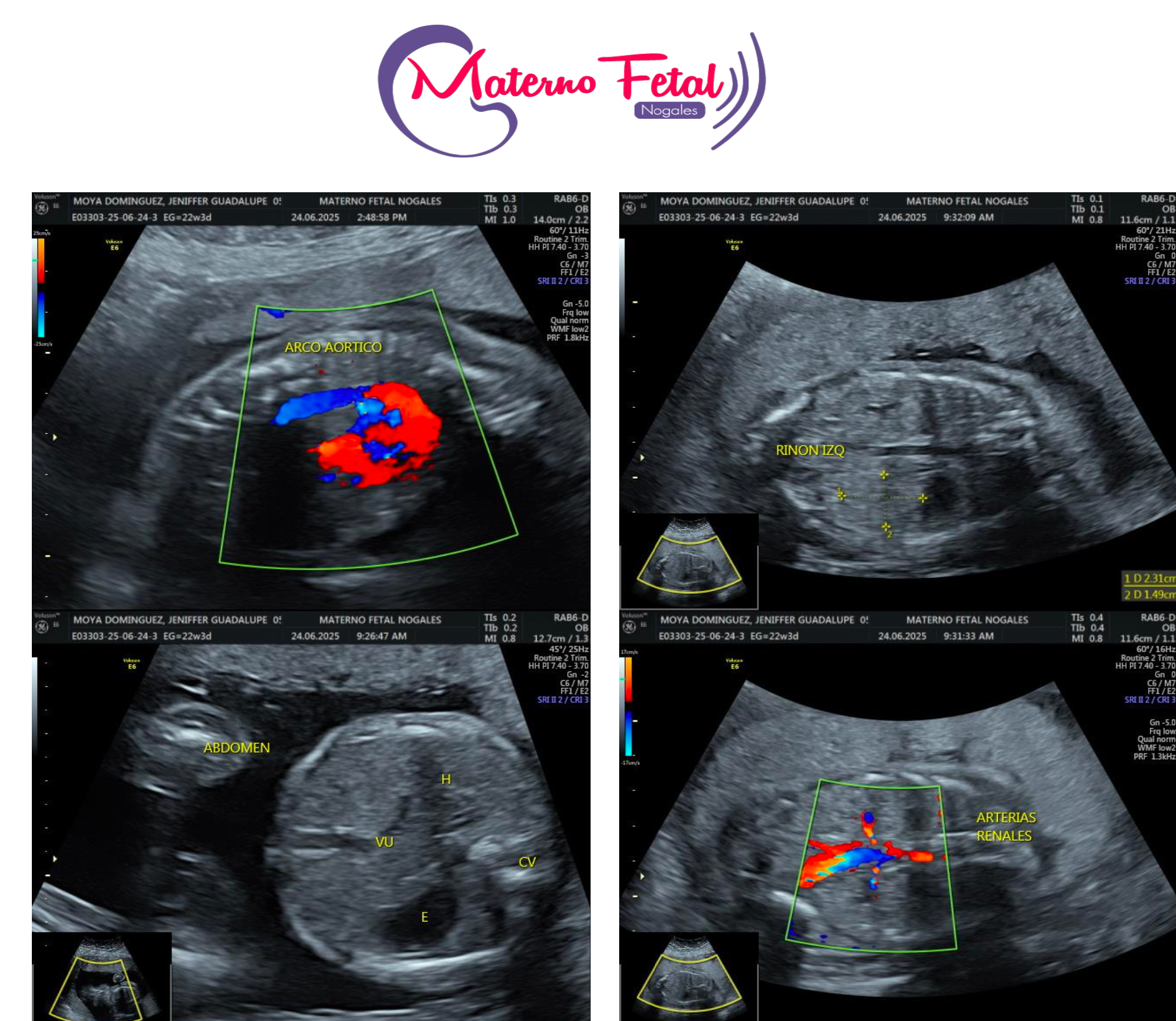 Update on baby Liam Iván campaign photo, 7 of 8