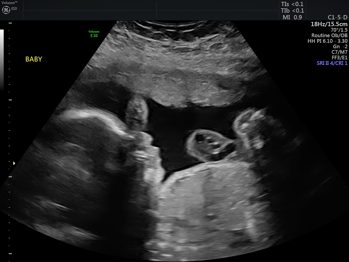 Aid for a Safe Hospital Stay and Healthy Baby campaign photo, 2 of 4