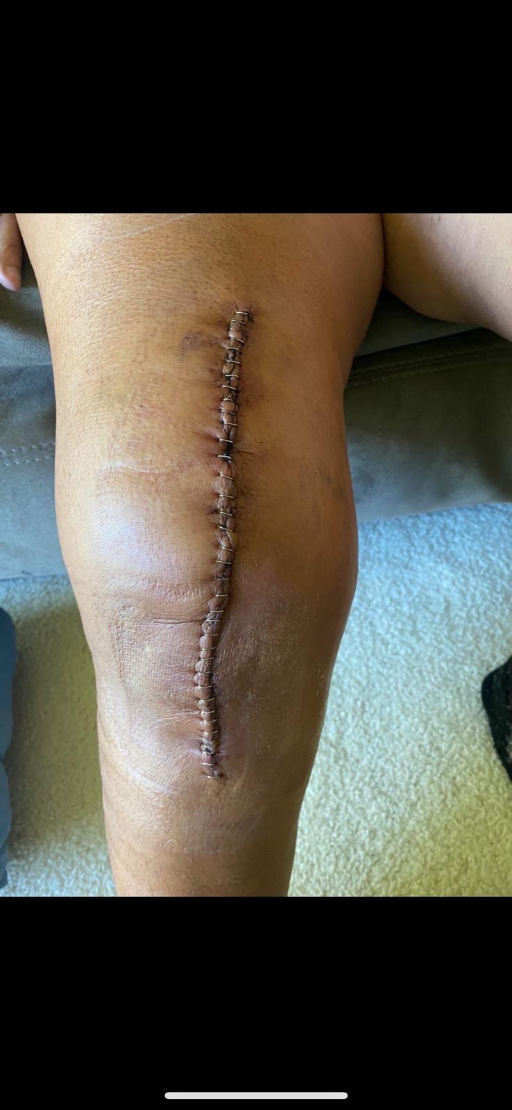 Help Celia heal and recover campaign photo, 5 of 6