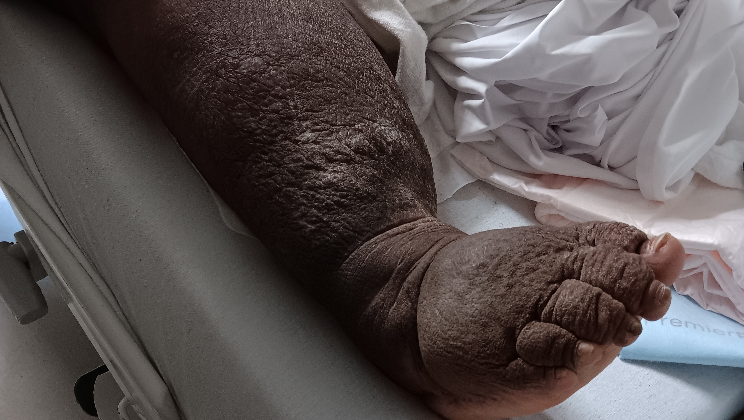 PLEASE HELP RUTH TO SURVIVE photo