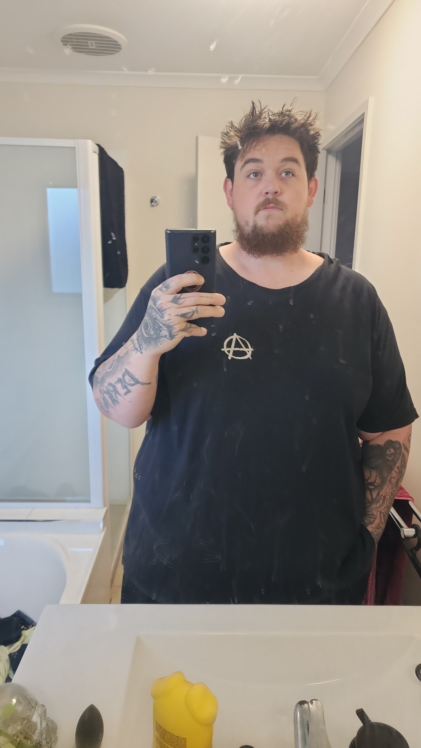 Support Nik's Weight Loss Surgery Journey campaign photo, 2 of 4