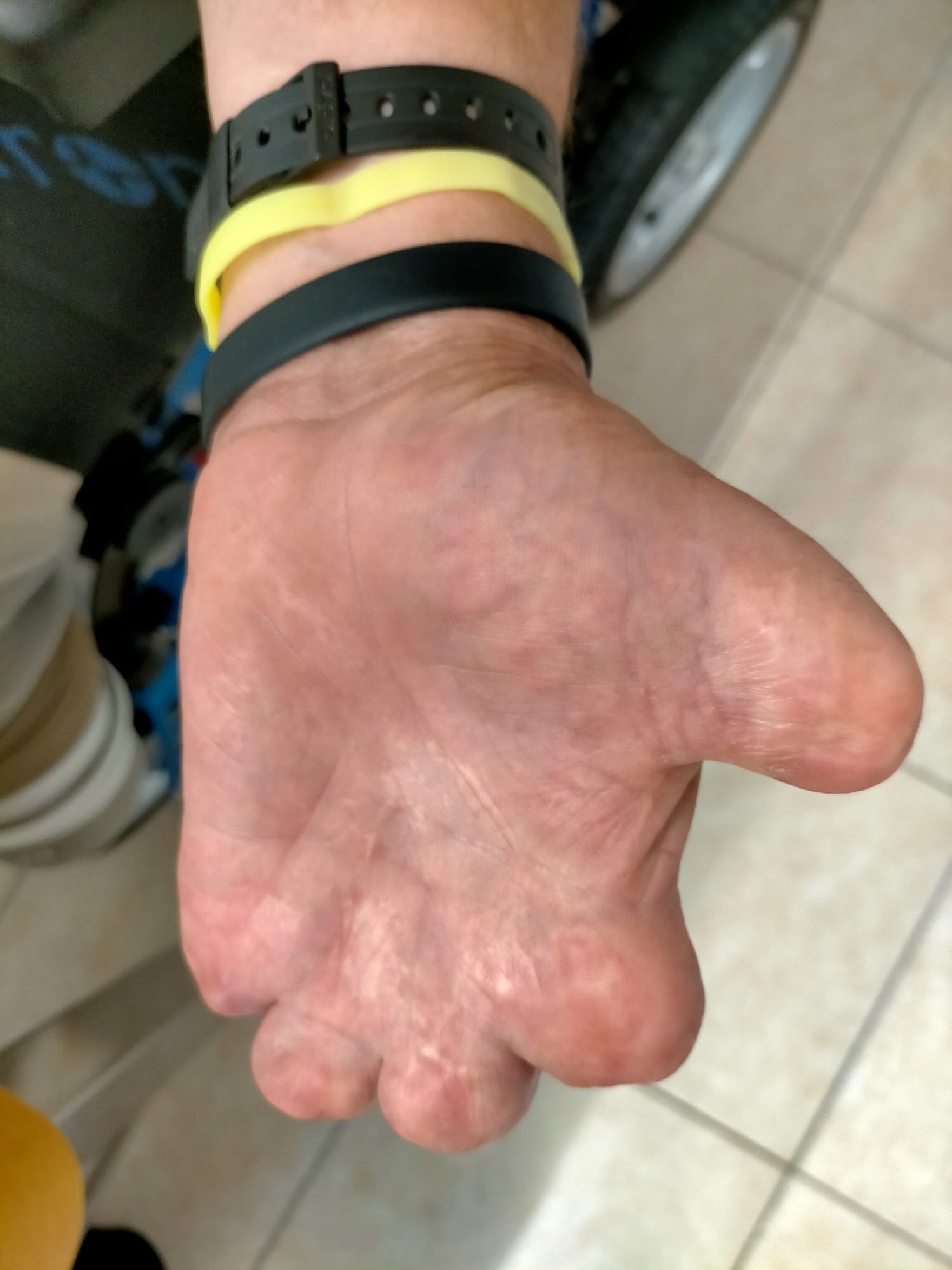 2 ruote e una gamba e una mano campaign photo, 4 of 7