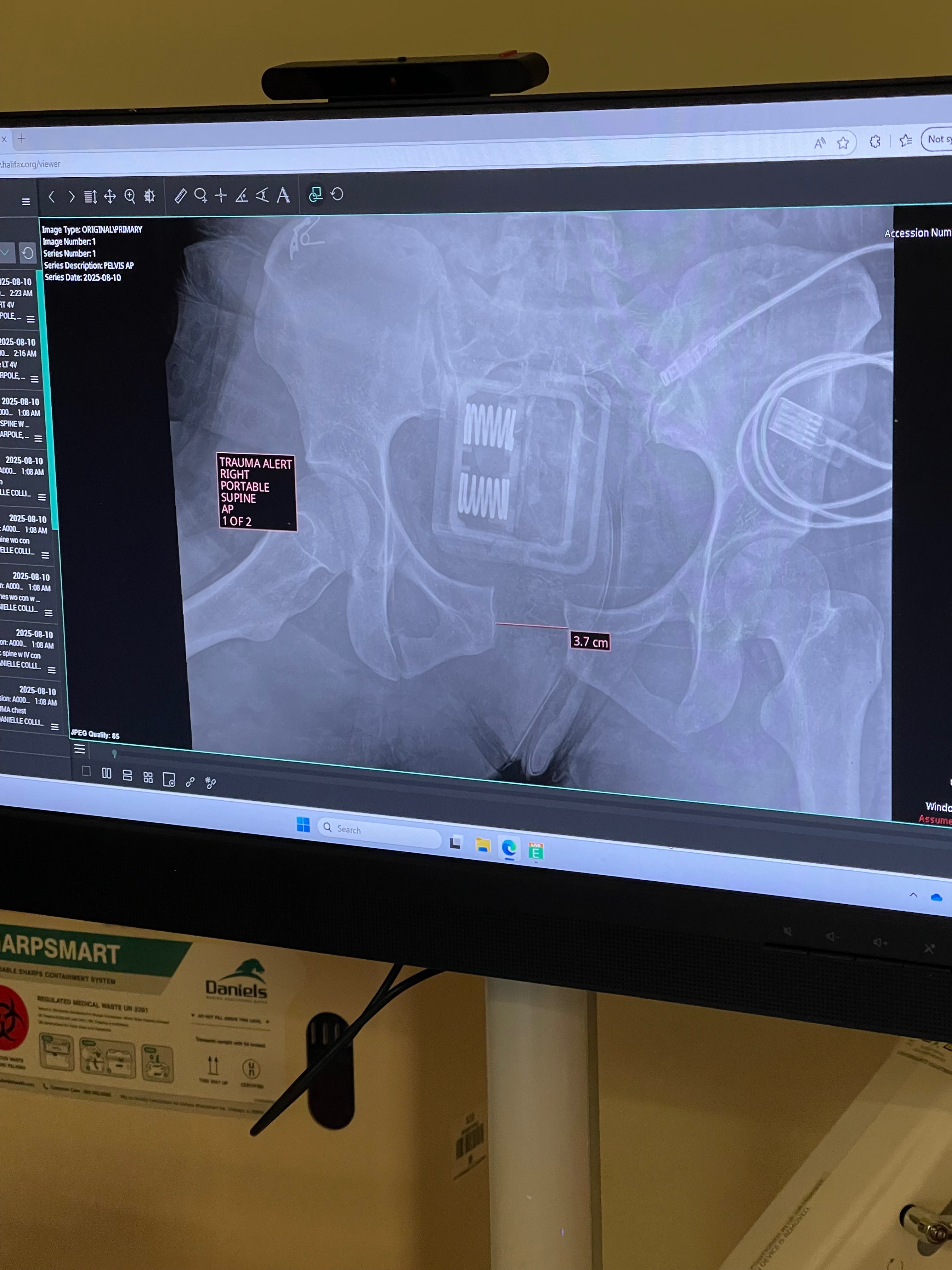“Standing Strong Again: Kayla’s Pelvic Break Recovery Fund” campaign photo, 4 of 8