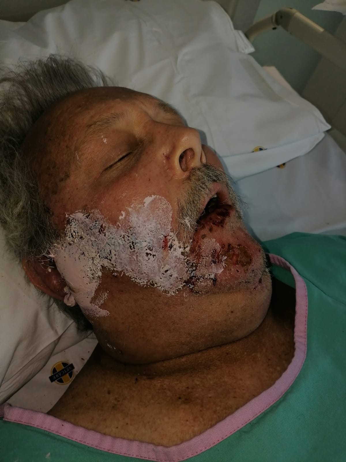 Hope for Kevin: home nursing and physiotherapy costs campaign photo, 4 of 5
