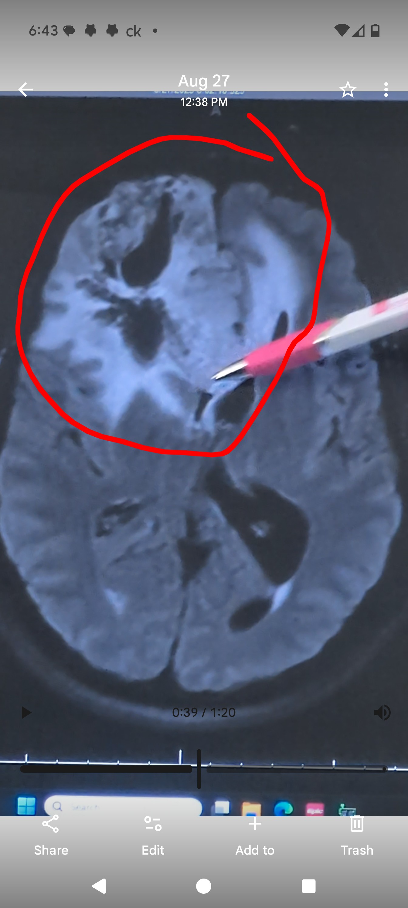 No brain no pain! campaign photo, 2 of 4