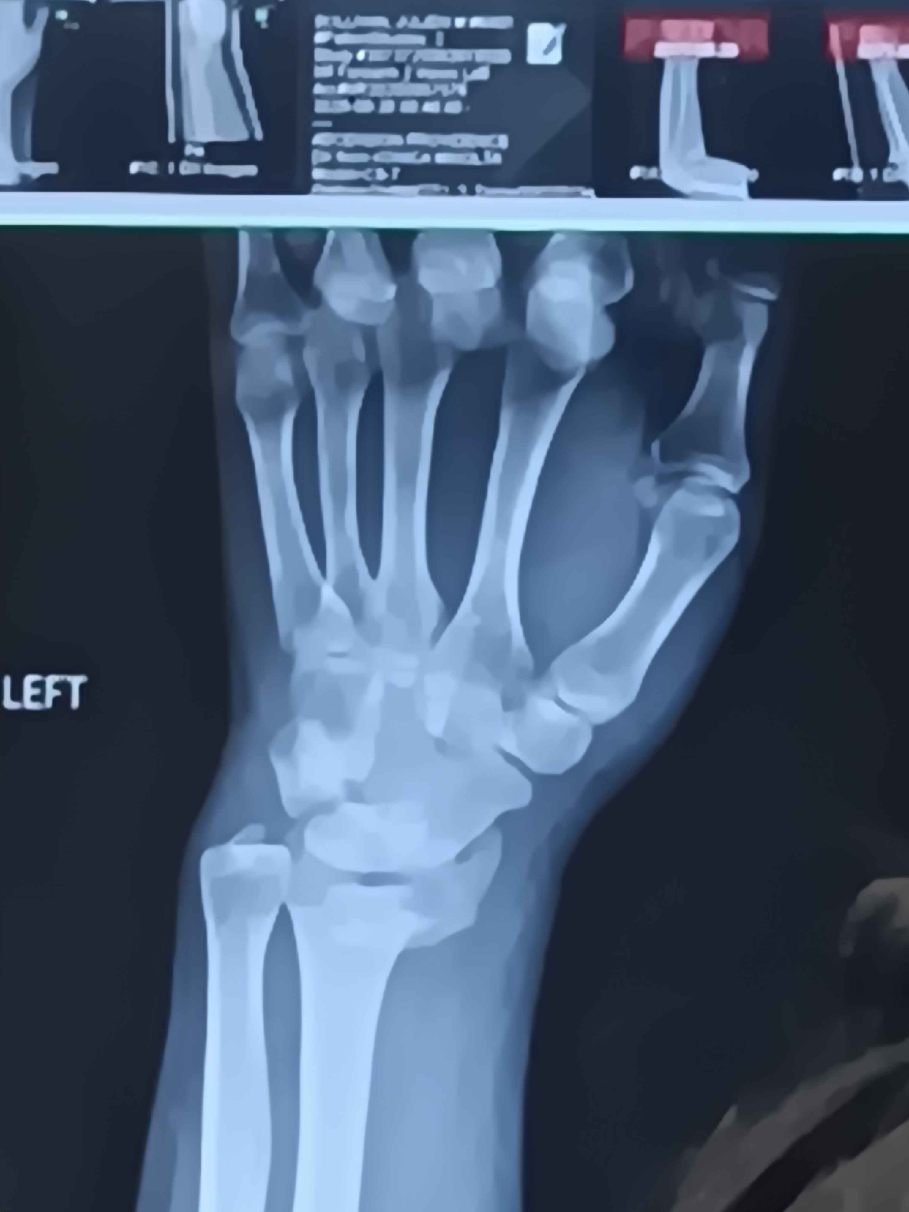 Help Julien Cover Medical Bills After Accident campaign photo, 5 of 6