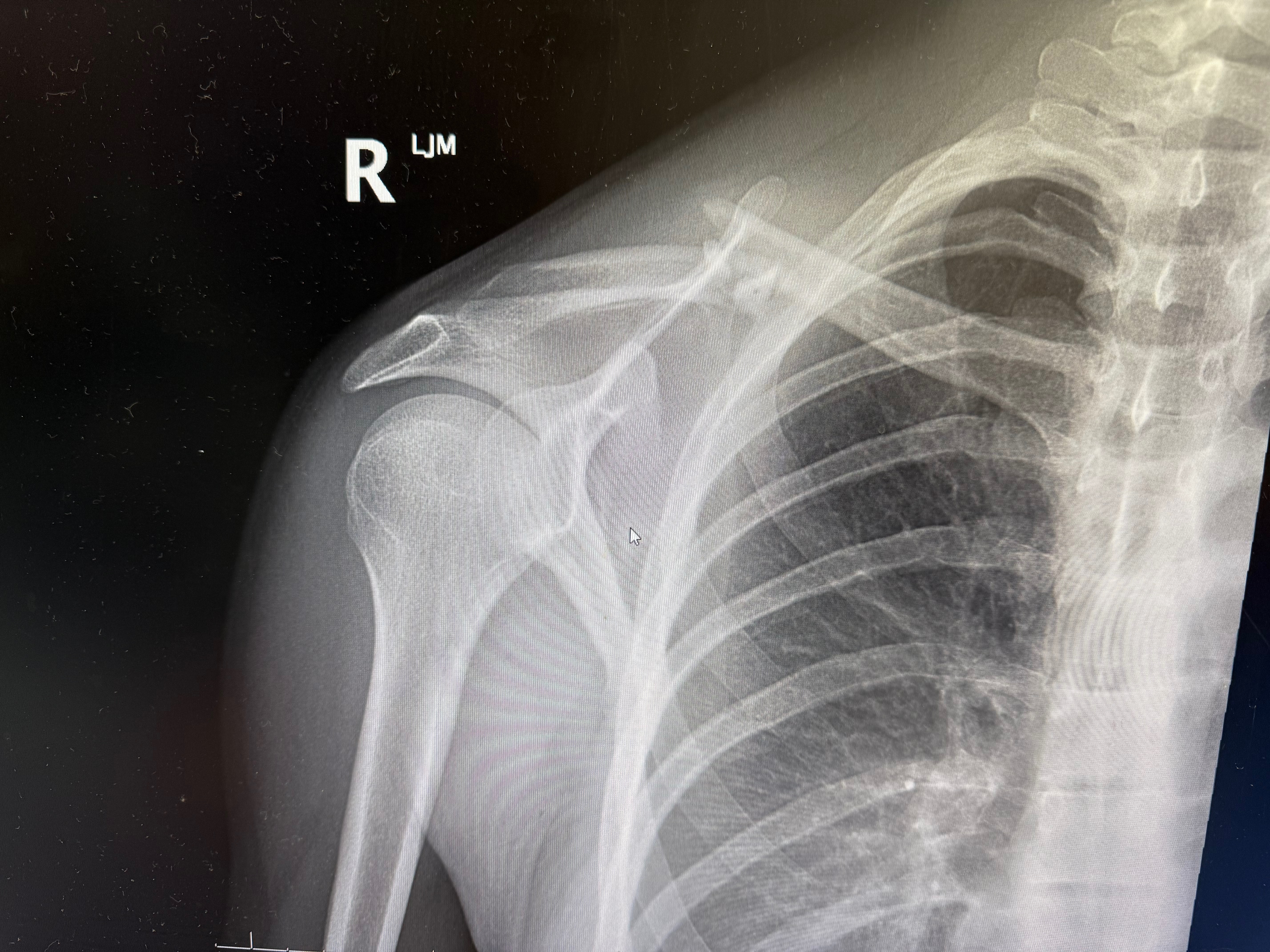 Saraya Saber and the Broken Collarbone Party campaign photo, 2 of 4