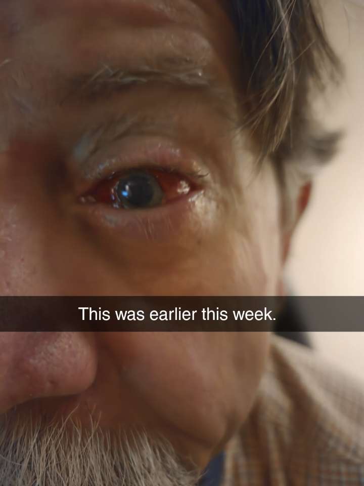 medical bills for an unexpected eye injury campaign photo, 6 of 7