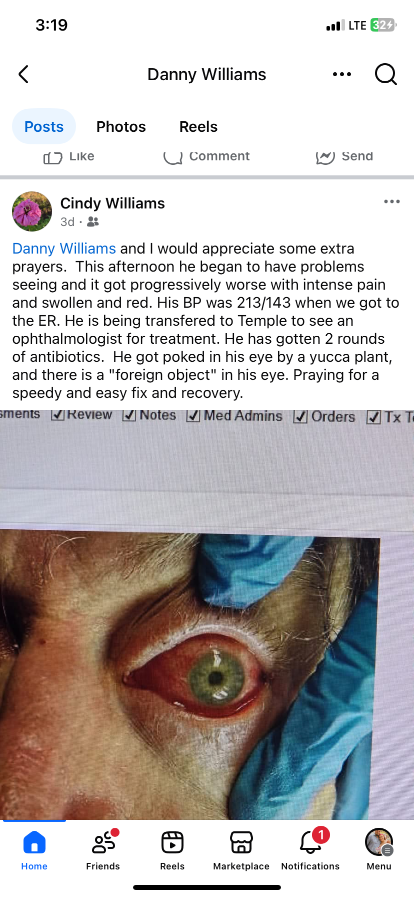 medical bills for an unexpected eye injury campaign photo, 4 of 7