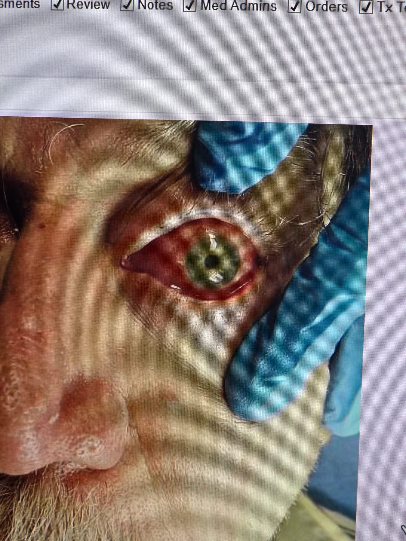 medical bills for an unexpected eye injury campaign photo, 5 of 7