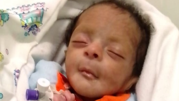 Save Baby Rosiel: Born with Life-Threatening Condition photo