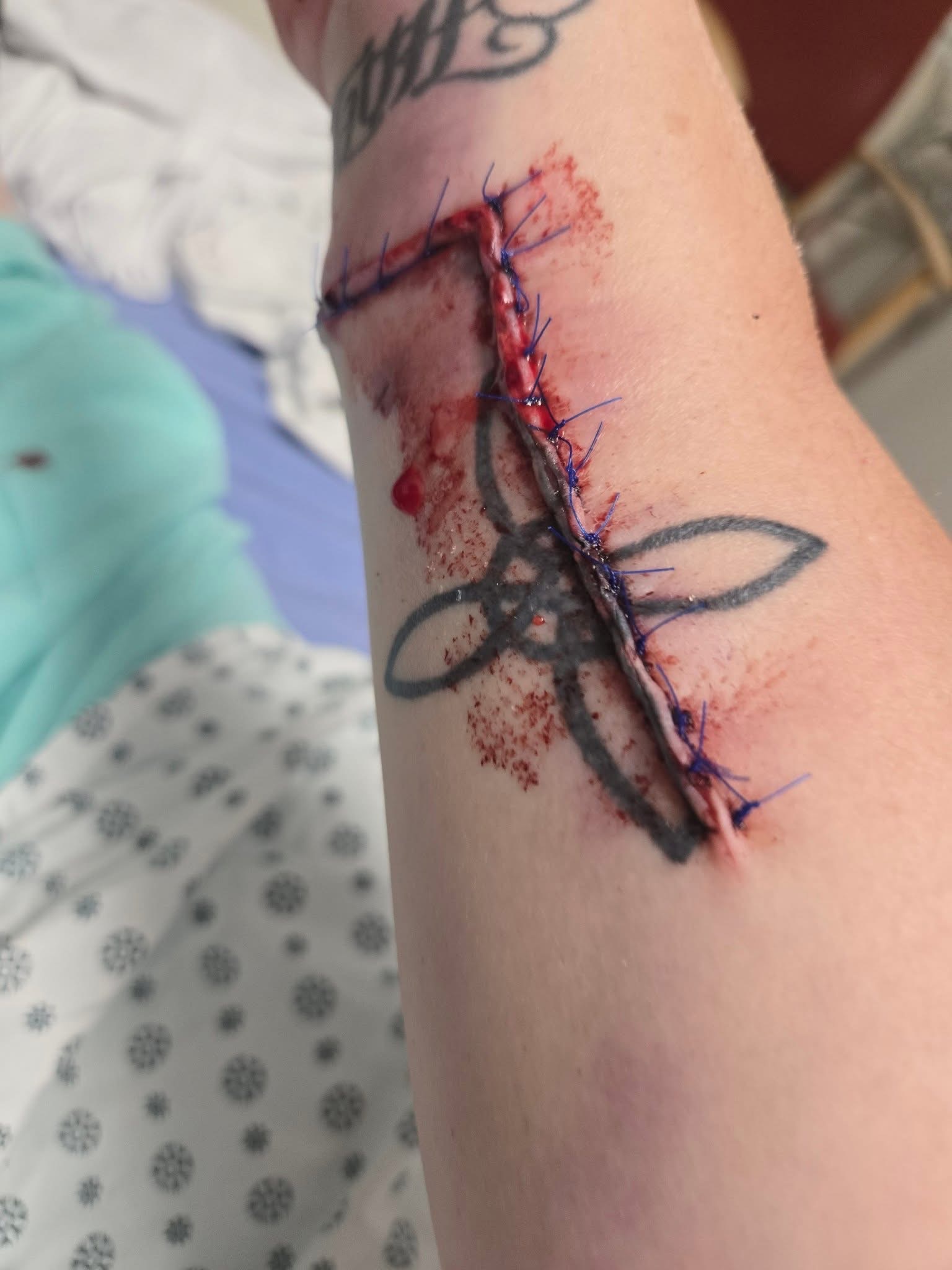 Help my friend Brittany who took the bite to save Corgi Nova campaign photo, 4 of 7