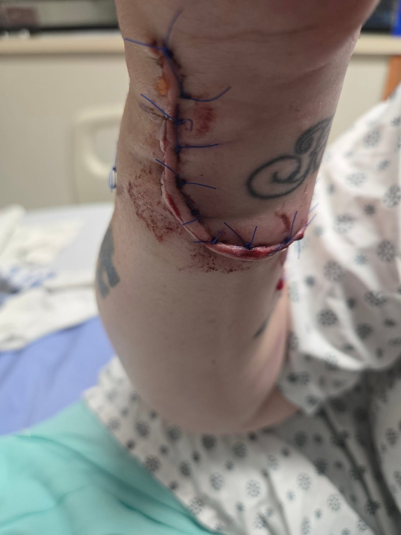 Help my friend Brittany who took the bite to save Corgi Nova campaign photo, 5 of 7