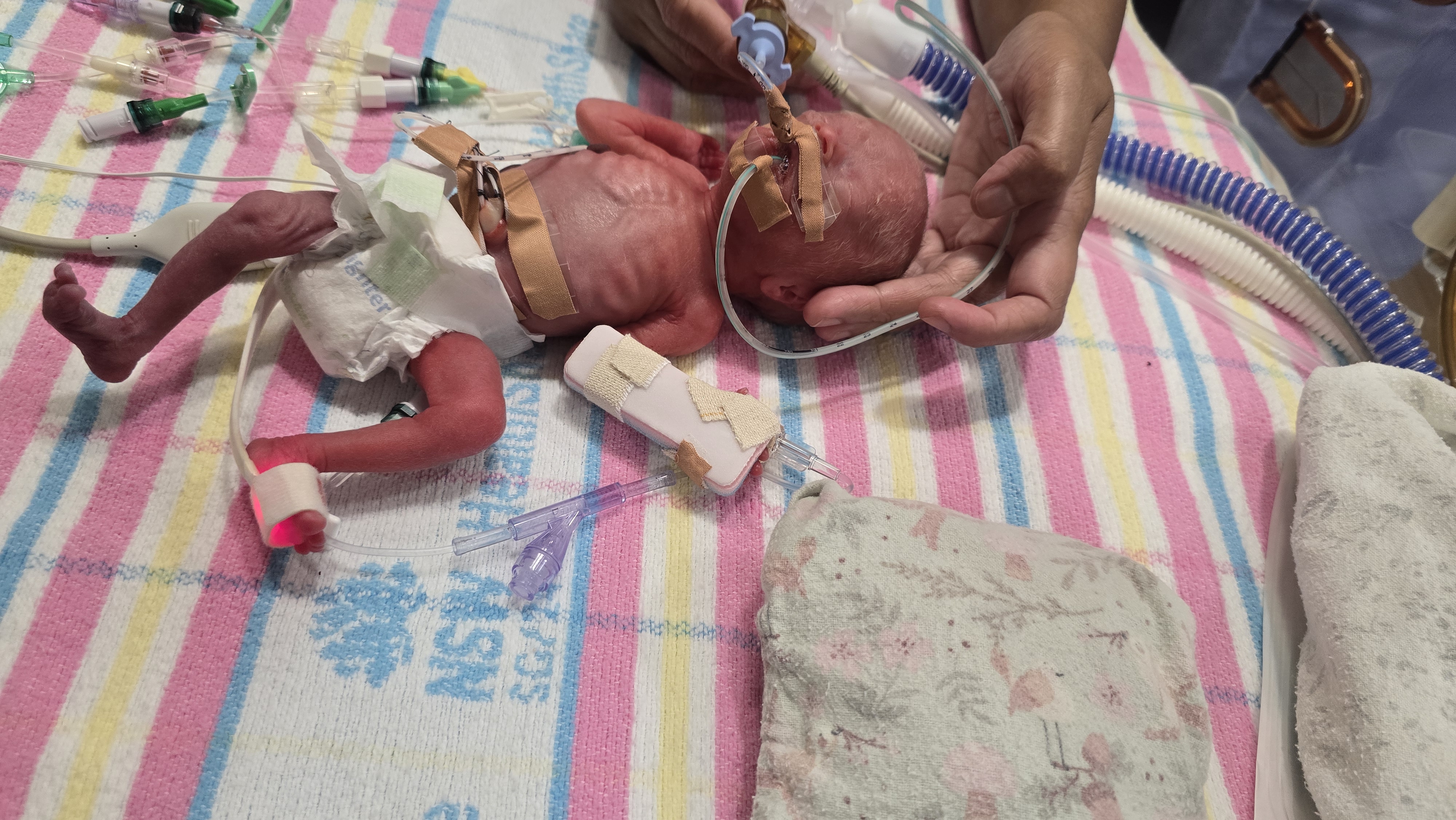 Help Support Baby Evelyn - Our Little Fighter campaign photo, 2 of 8