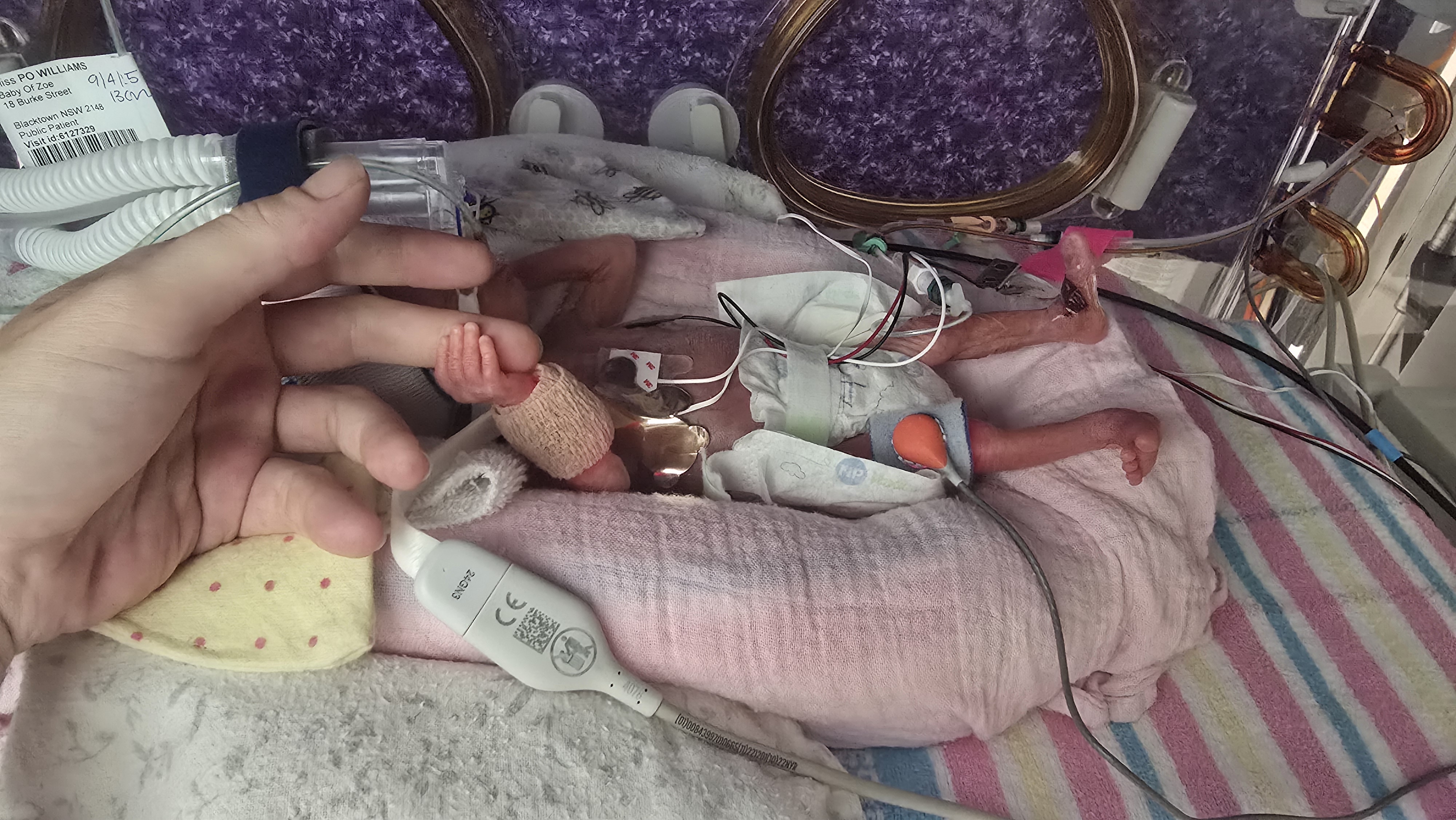 Help Support Baby Evelyn - Our Little Fighter campaign photo, 4 of 8