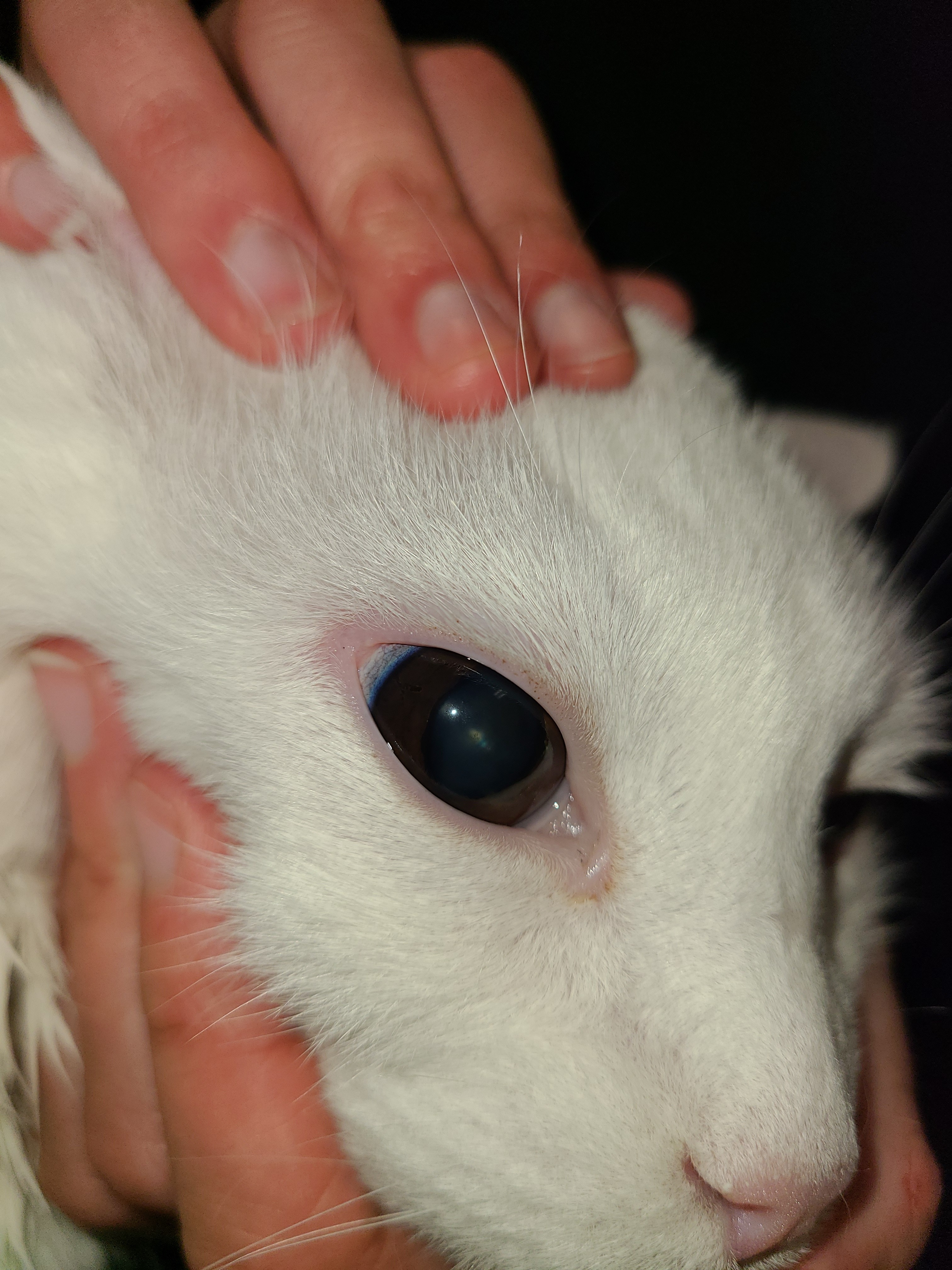 Bruce's eye melanoma campaign photo, 2 of 5
