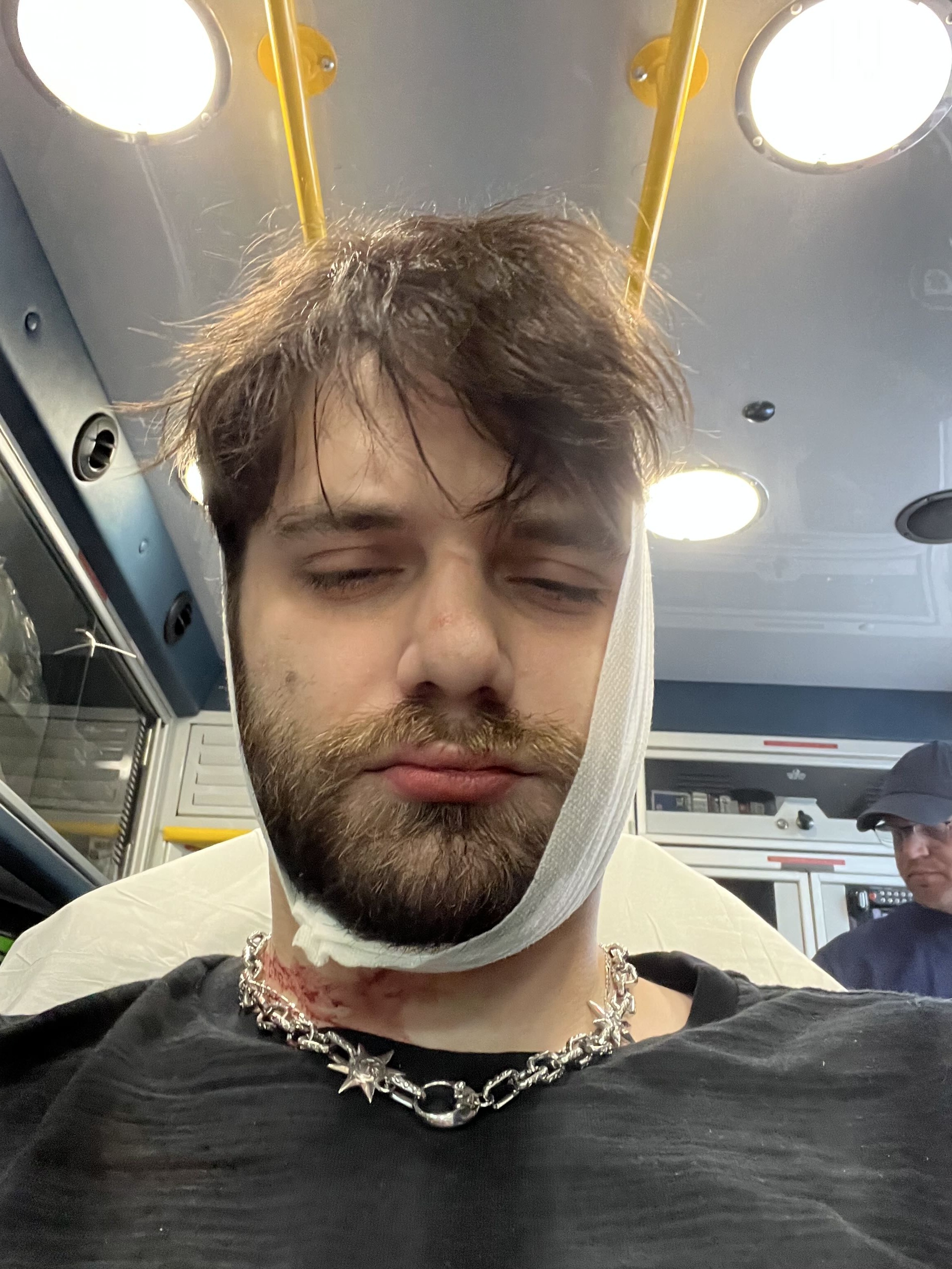 Help Gary: From celebrating his birthday to breaking his jaw campaign photo, 5 of 7