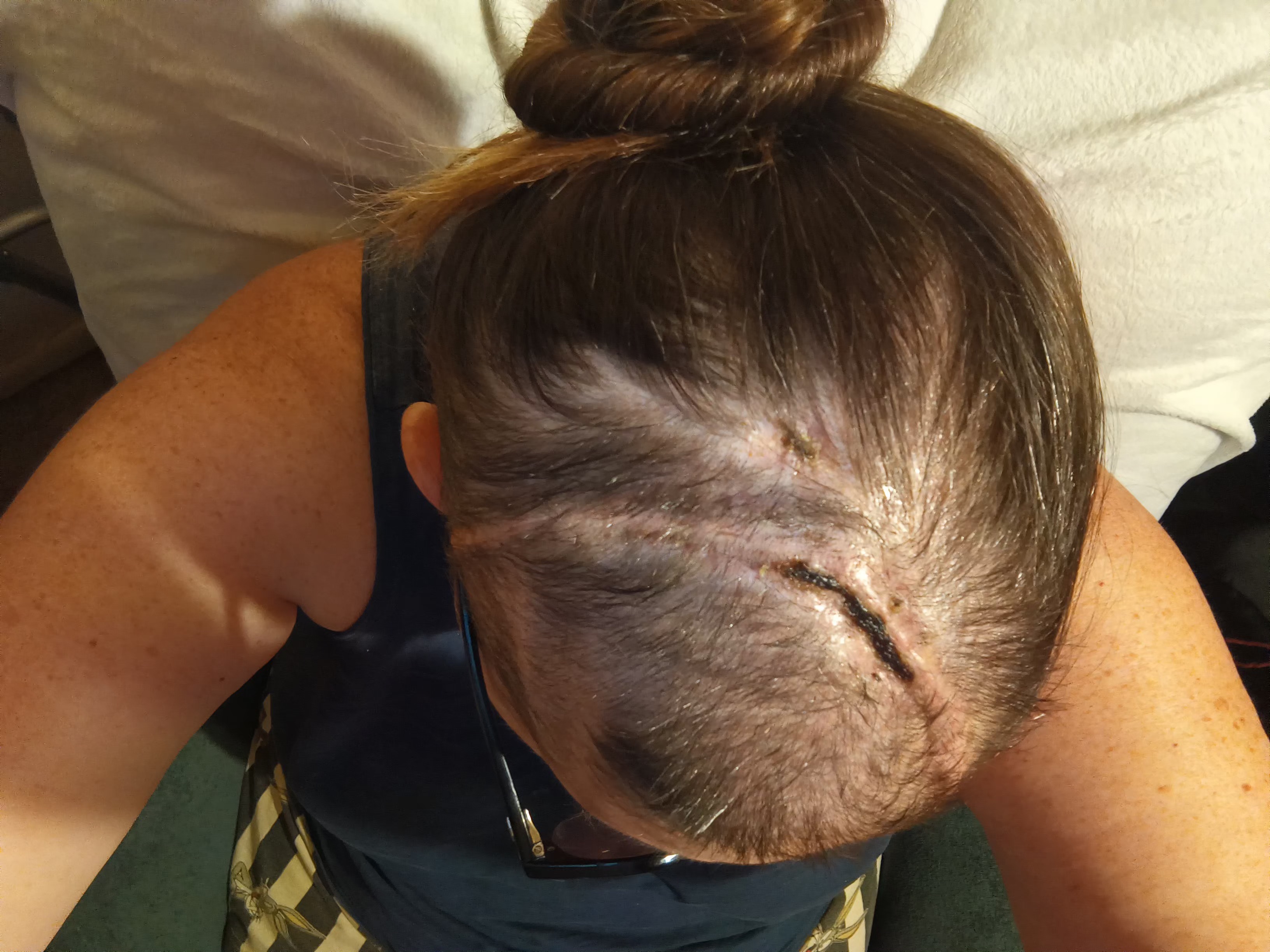 Support Shonna’s Brain Tumor Recovery campaign photo, 2 of 4